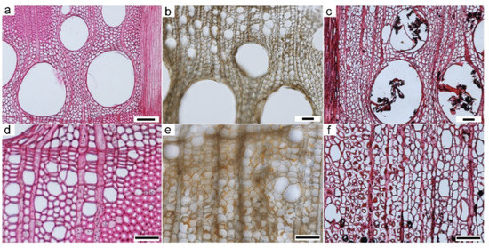 Scanning Electron Microscopy Protocol for Studying Anatomy