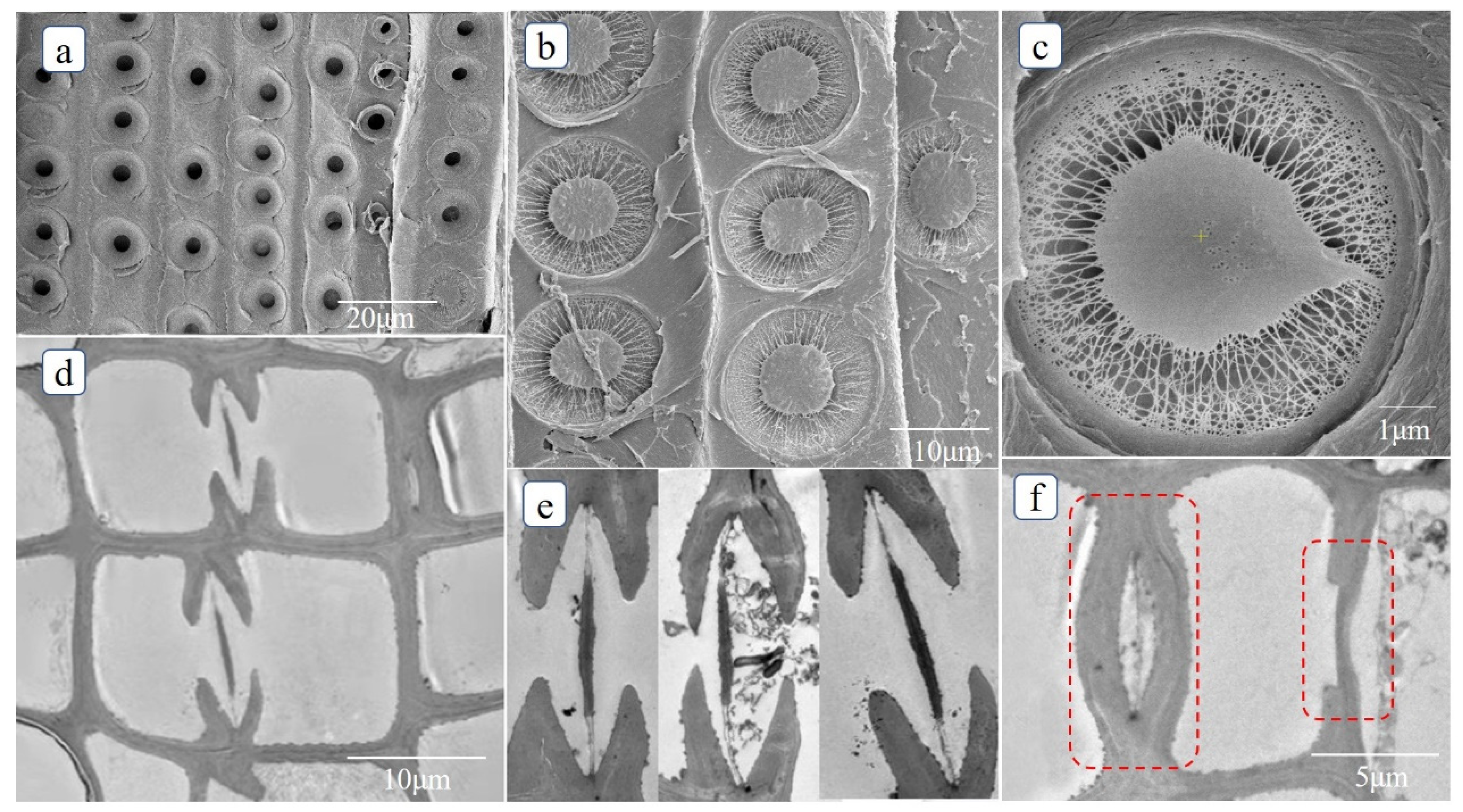Forests | Free Full-Text | Hydraulic Function Analysis of Conifer Xylem  Based on a Model Incorporating Tracheids, Bordered Pits, and Cross-Field  Pits