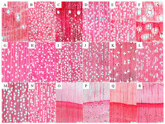 Evaluation of Wood Anatomical Properties from 18 Tree