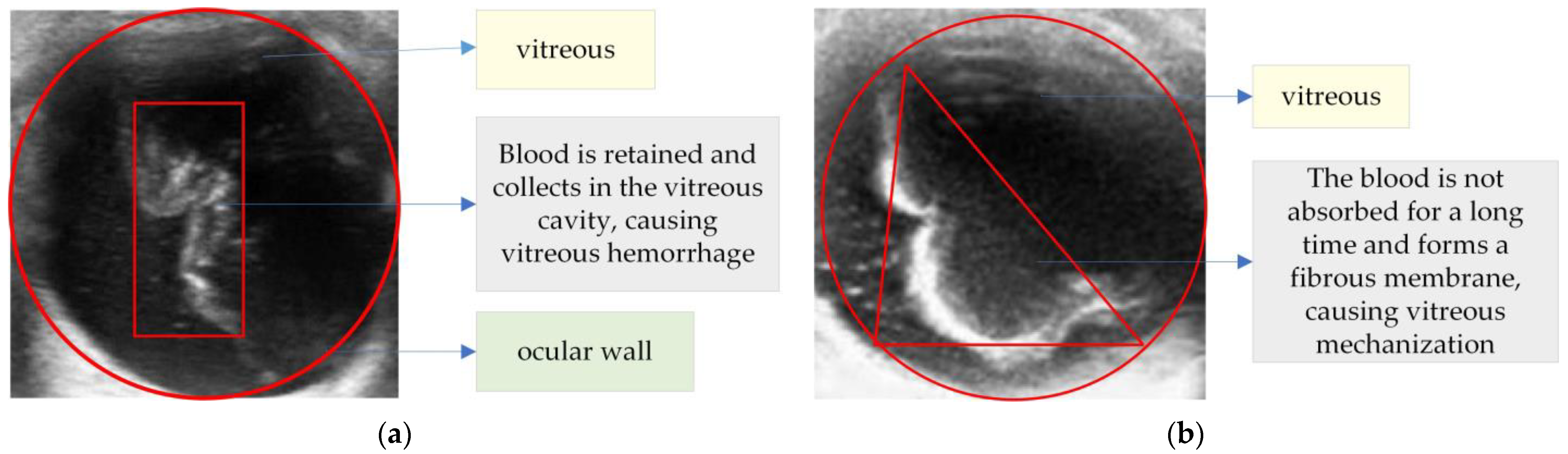Fractalfract 06 00508 g004 550
