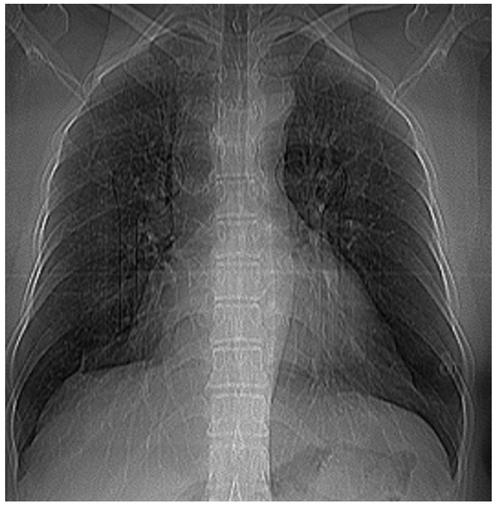 Fractalfract 07 00285 g012