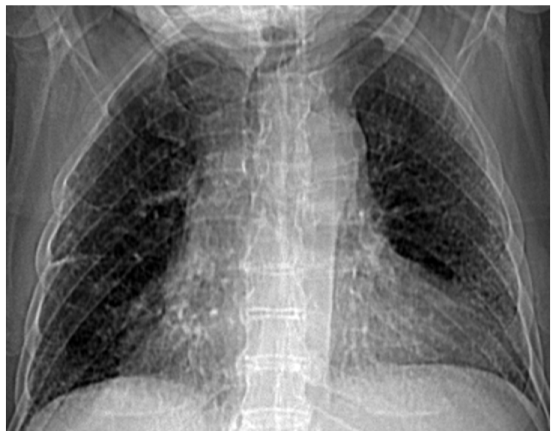 Fractalfract 07 00285 g017