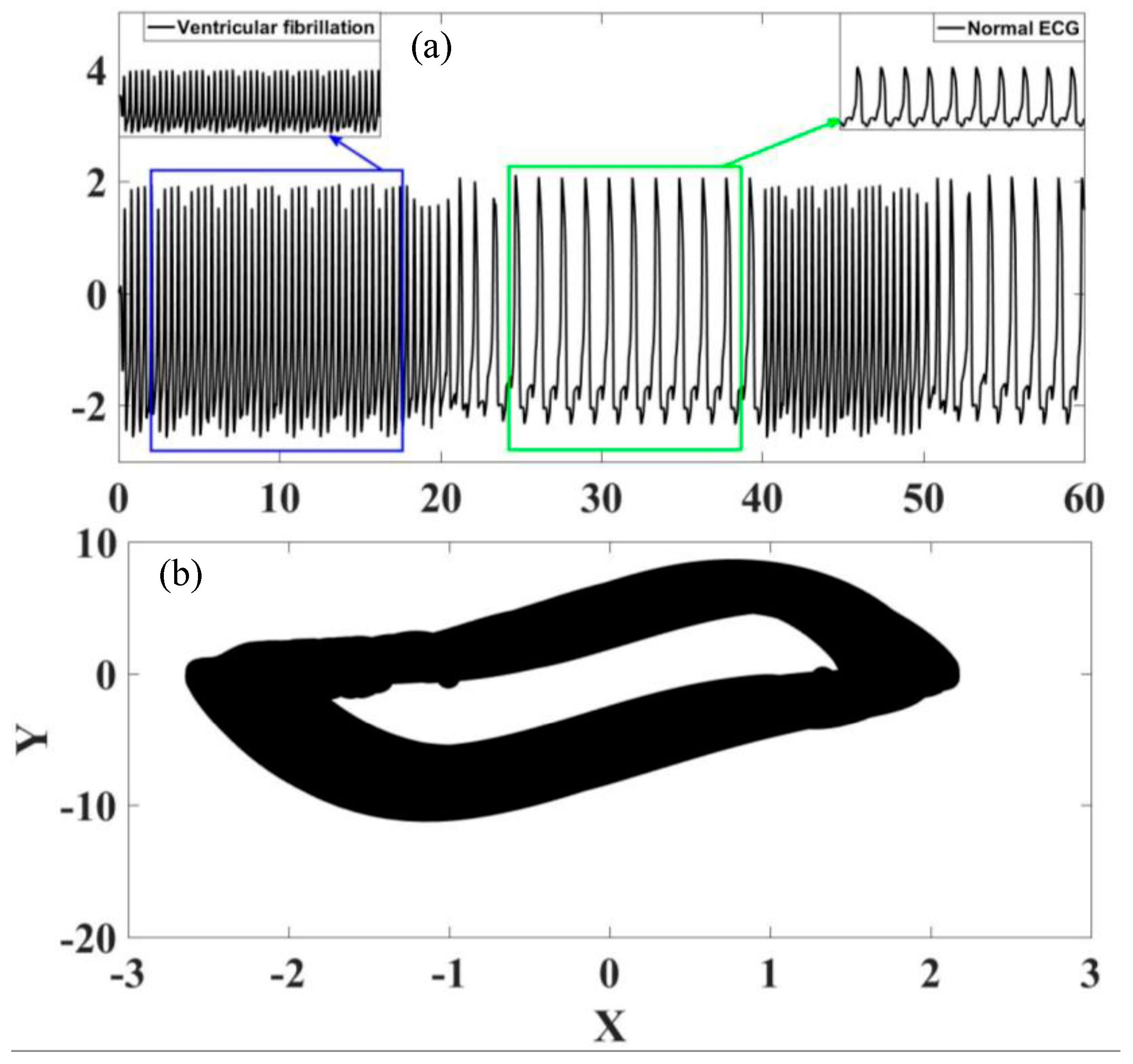Fractalfract 07 00592 g017 Fractalfract 07 00592 g017