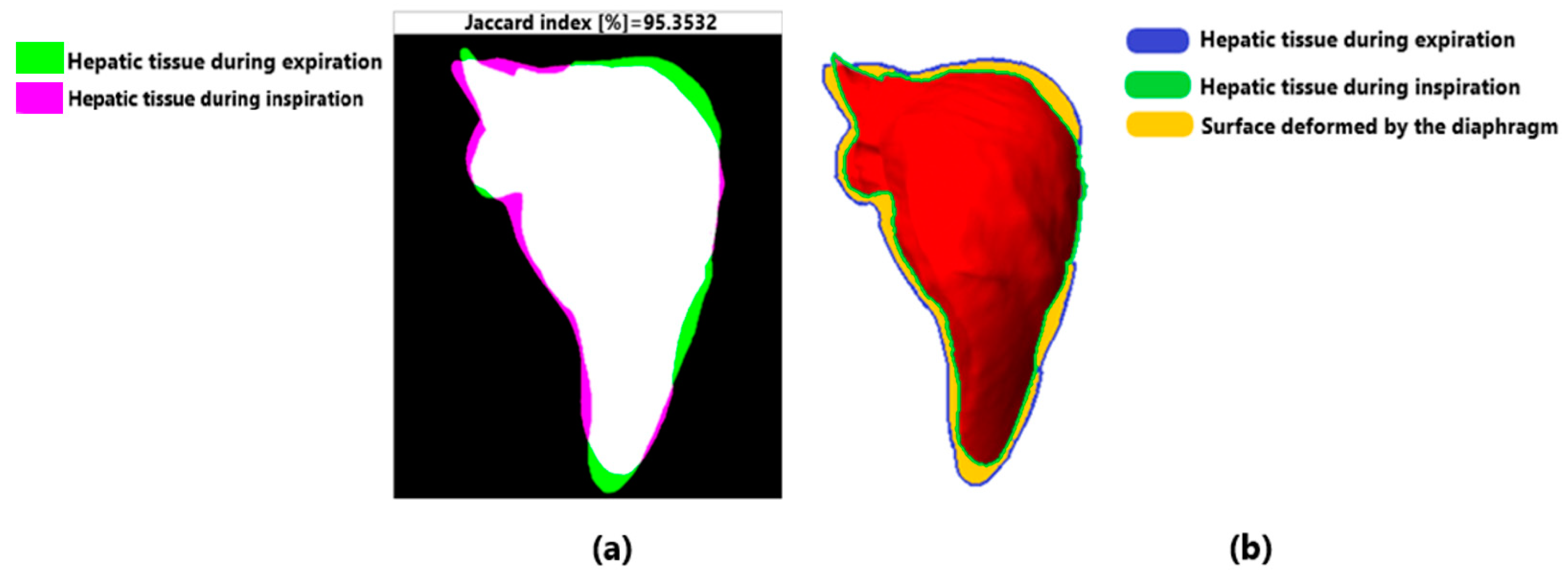 Fractalfract 07 00661 g008