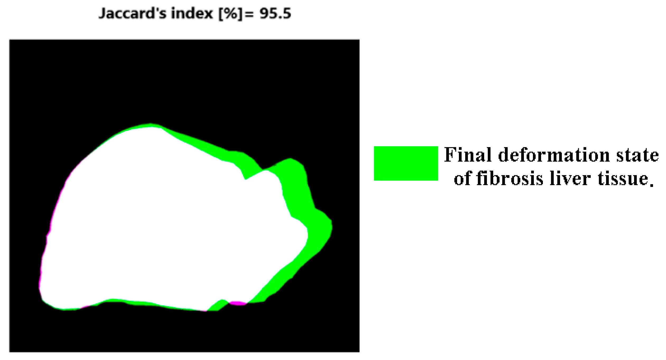Fractalfract 07 00661 g017