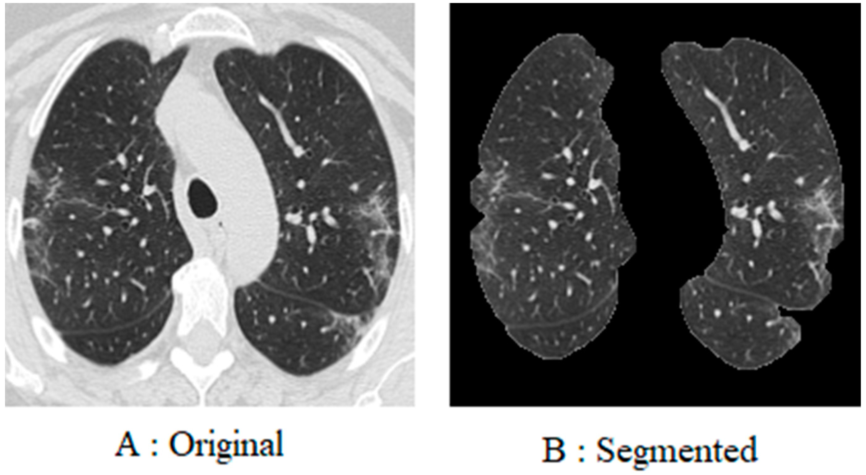 Fractalfract 08 00237 g004
