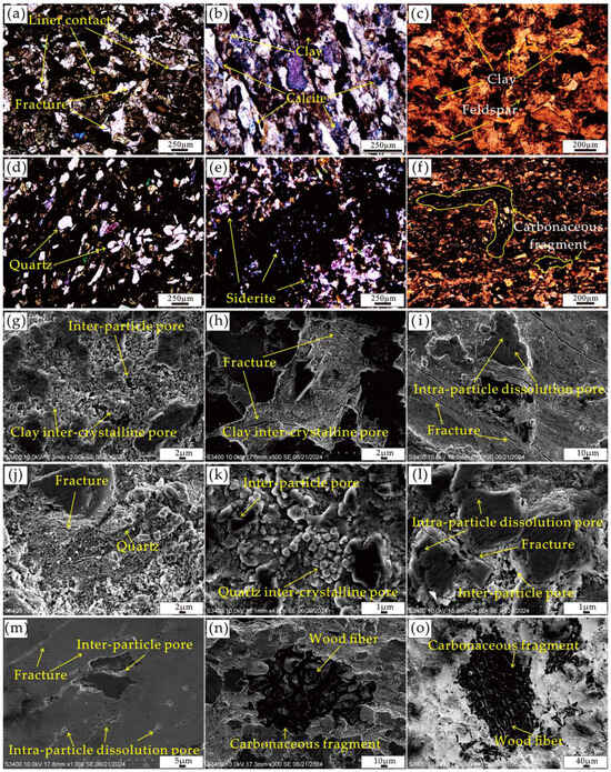 h Predictive factors for severe radiation-induced lung injury