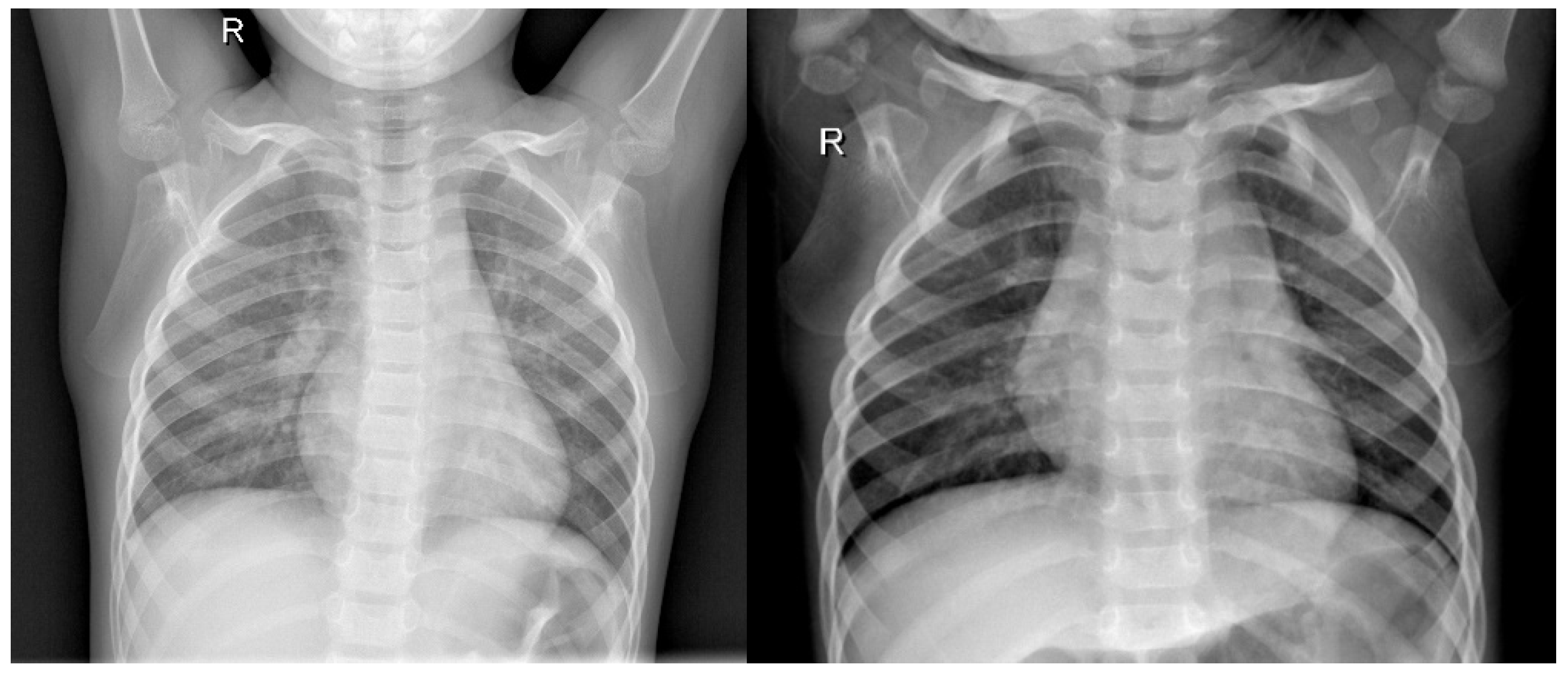 Fractalfract 09 00248 g005