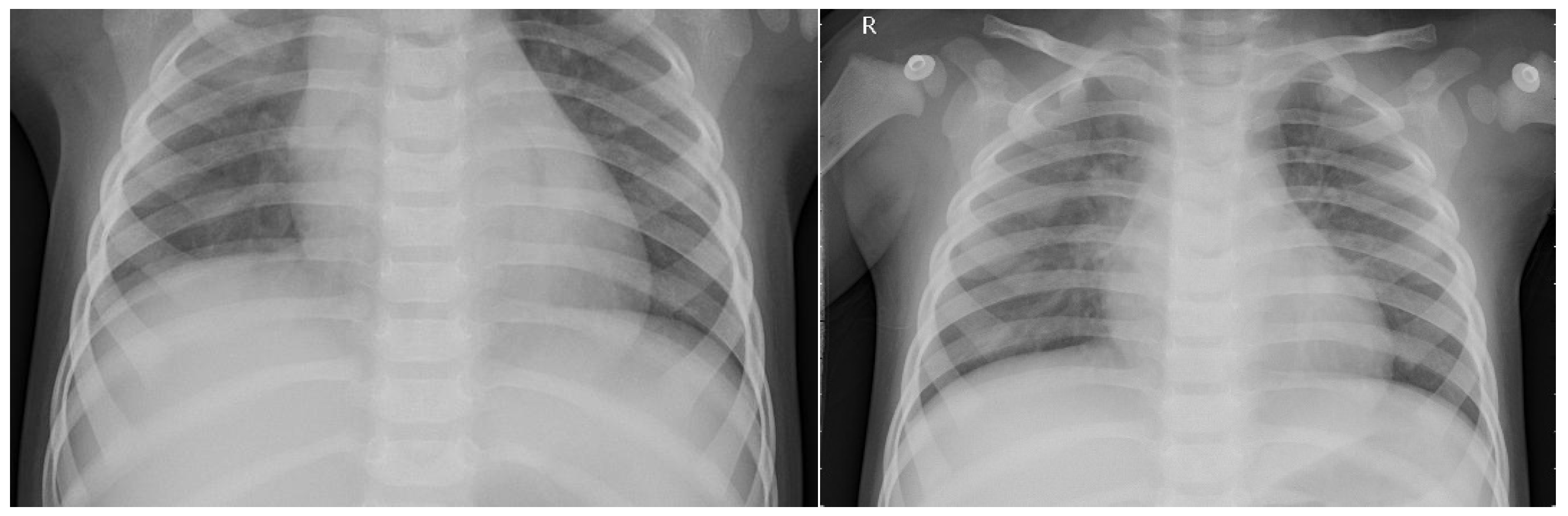 Fractalfract 09 00248 g006