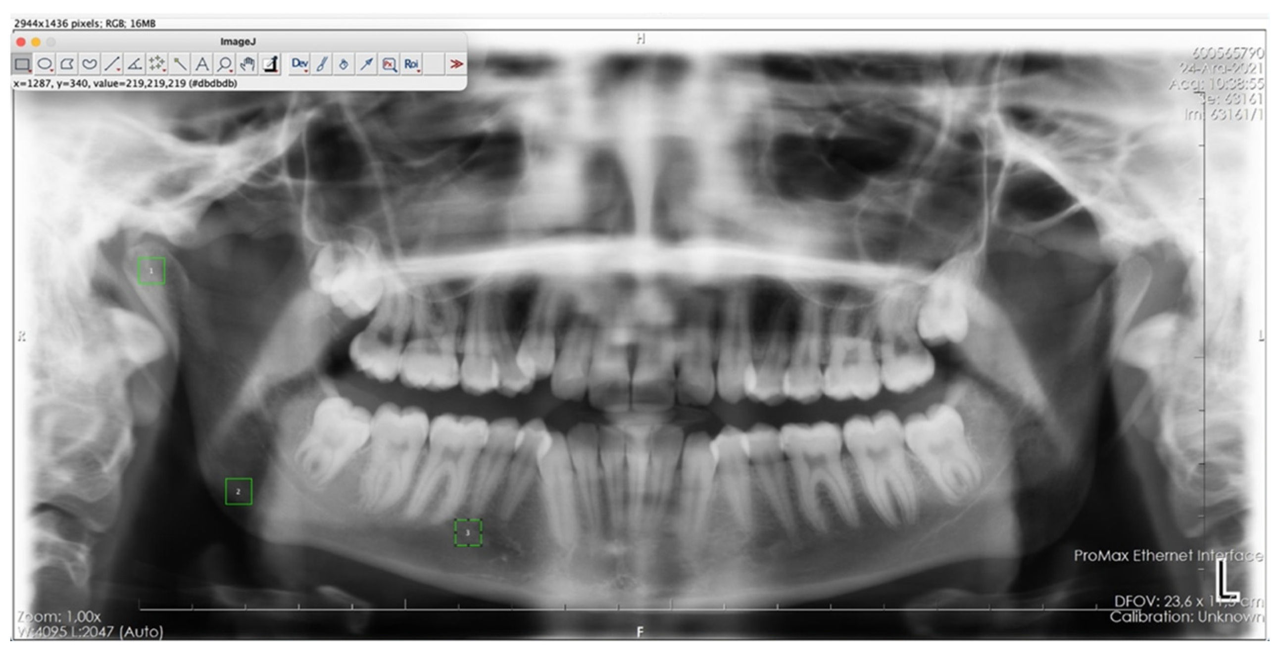 Fractalfract 09 00517 g002