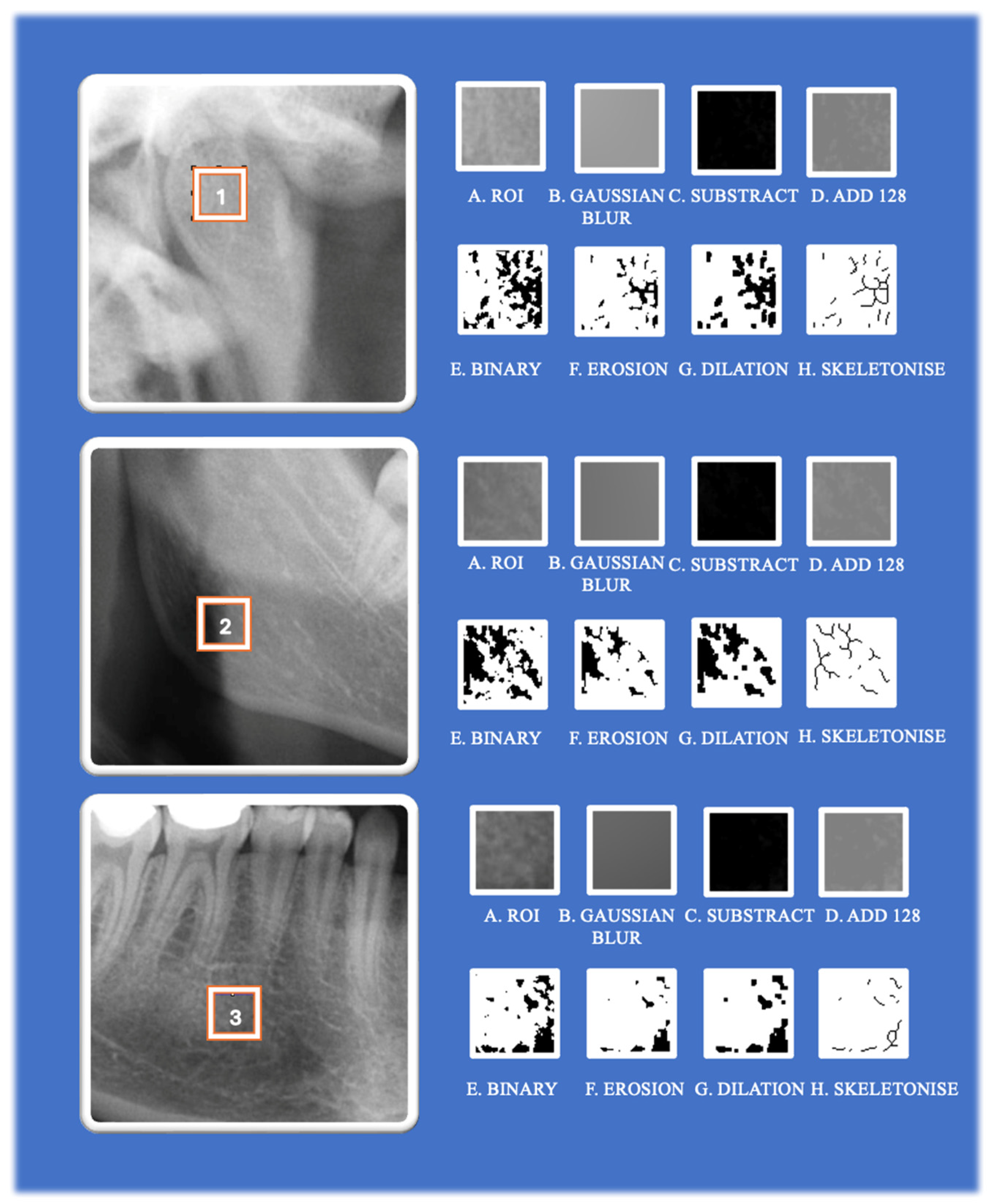 Fractalfract 09 00517 g003