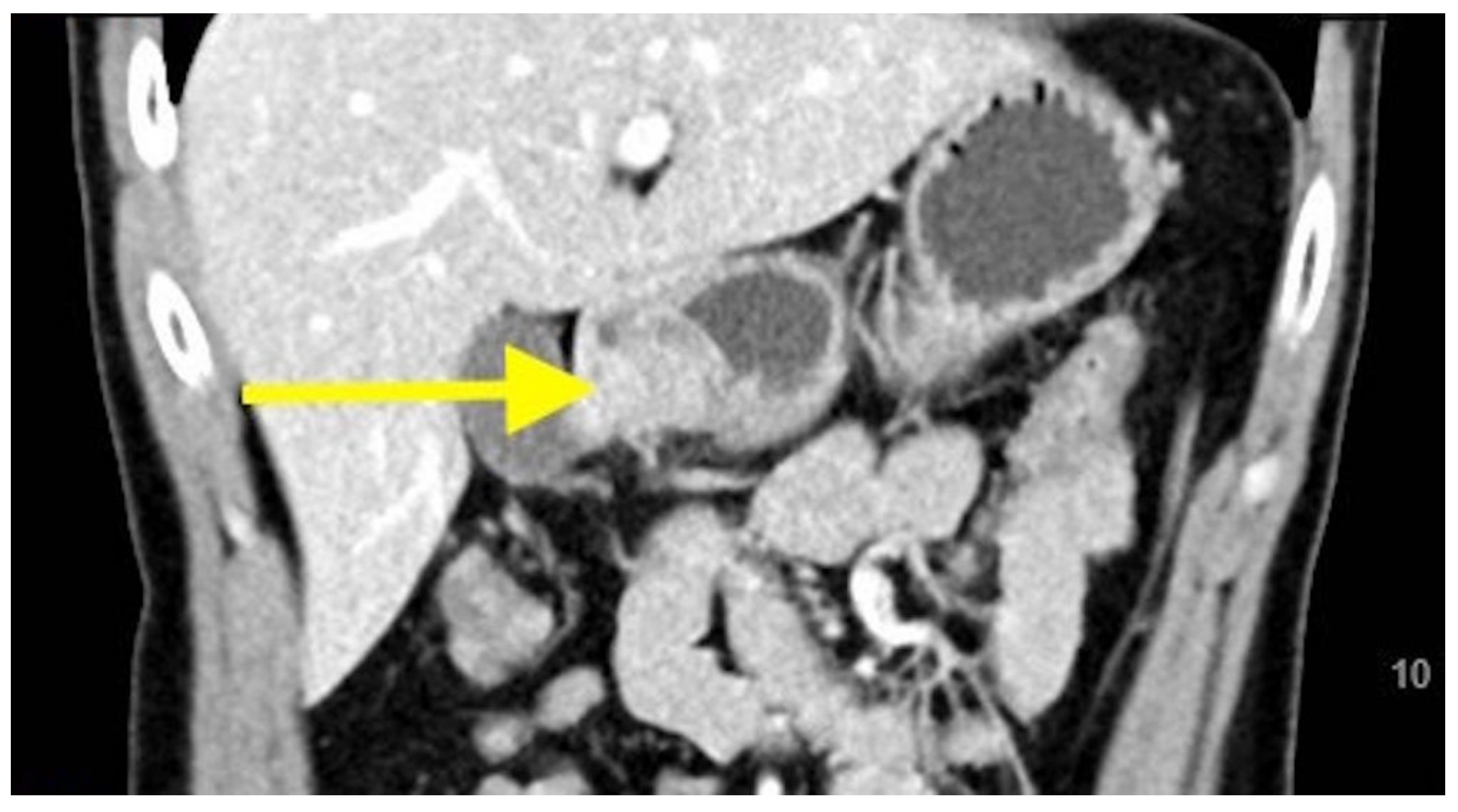 Gastroent 12 00002 g003 Gastroent 12 00002 g003