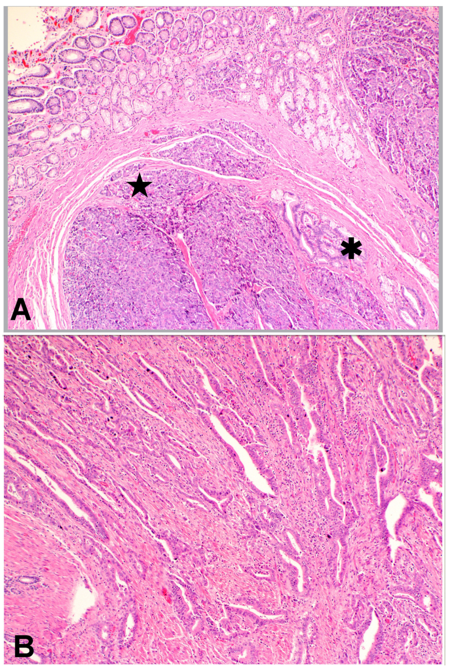 Gastroent 12 00002 g004 Gastroent 12 00002 g004