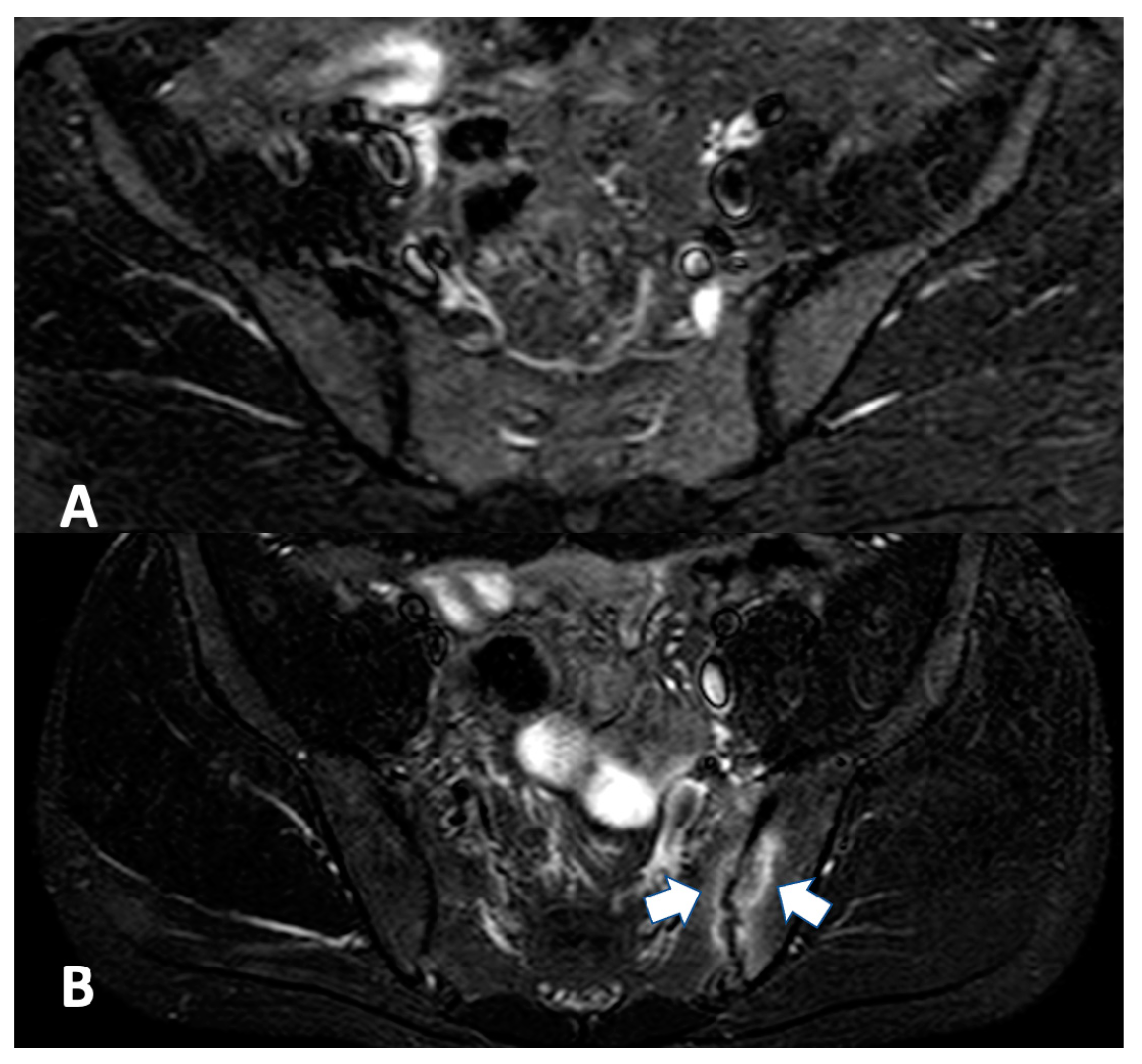 Gastroent 12 00010 g001 Gastroent 12 00010 g001