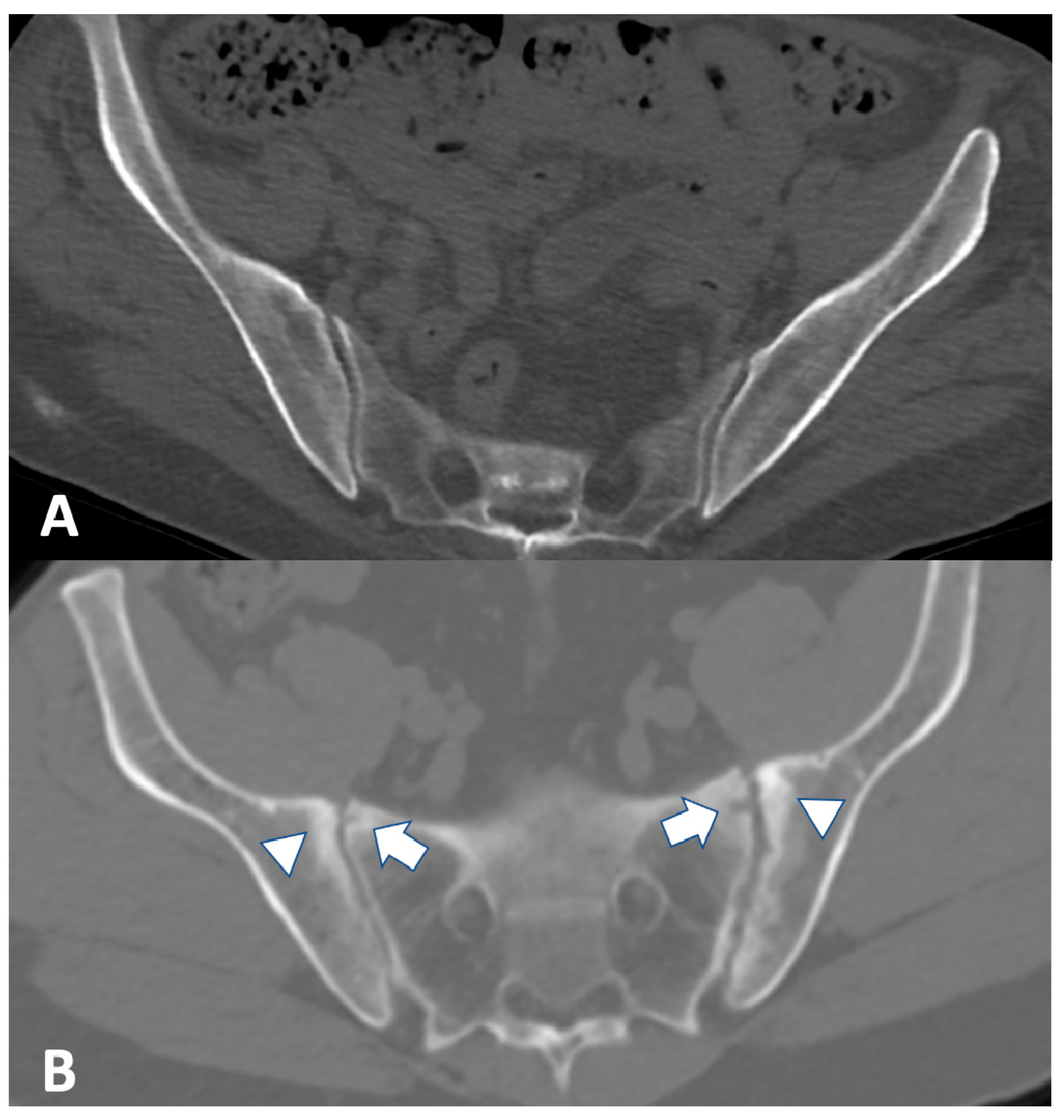 Gastroent 12 00010 g002 Gastroent 12 00010 g002
