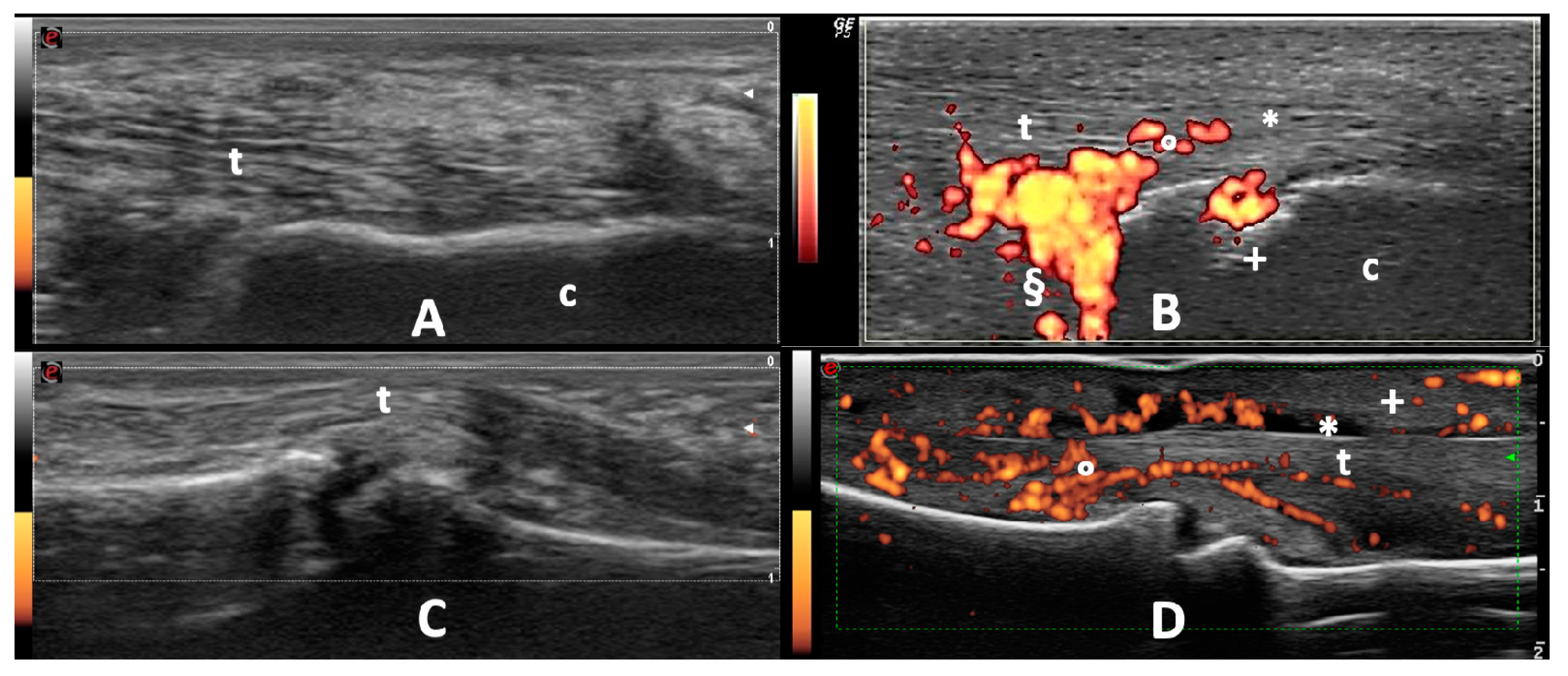 Gastroent 12 00010 g003 Gastroent 12 00010 g003