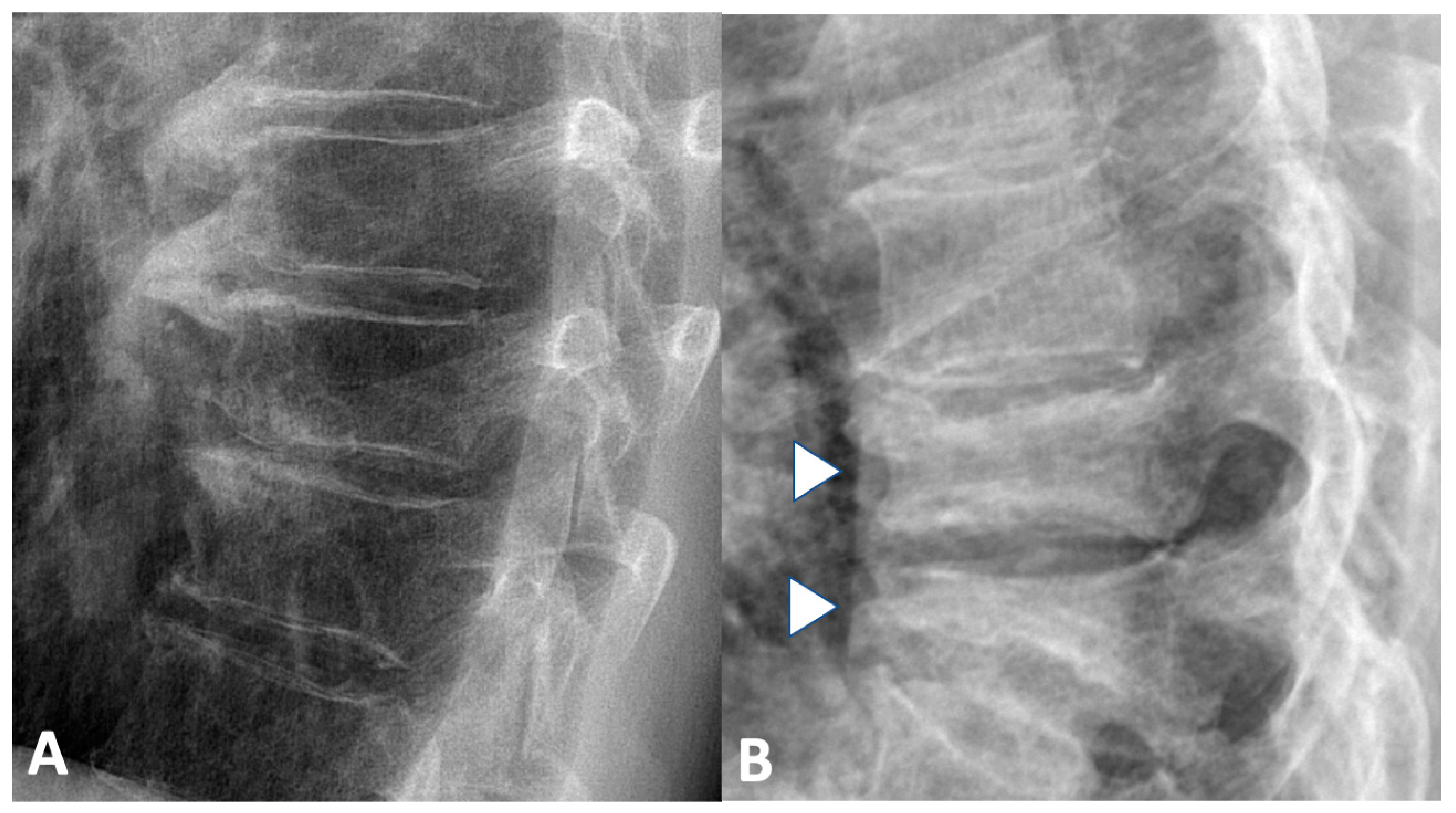 Gastroent 12 00010 g004 Gastroent 12 00010 g004