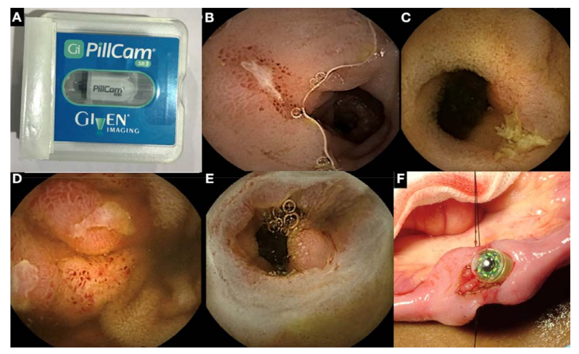 Gastroent 12 00021 g002 Gastroent 12 00021 g002