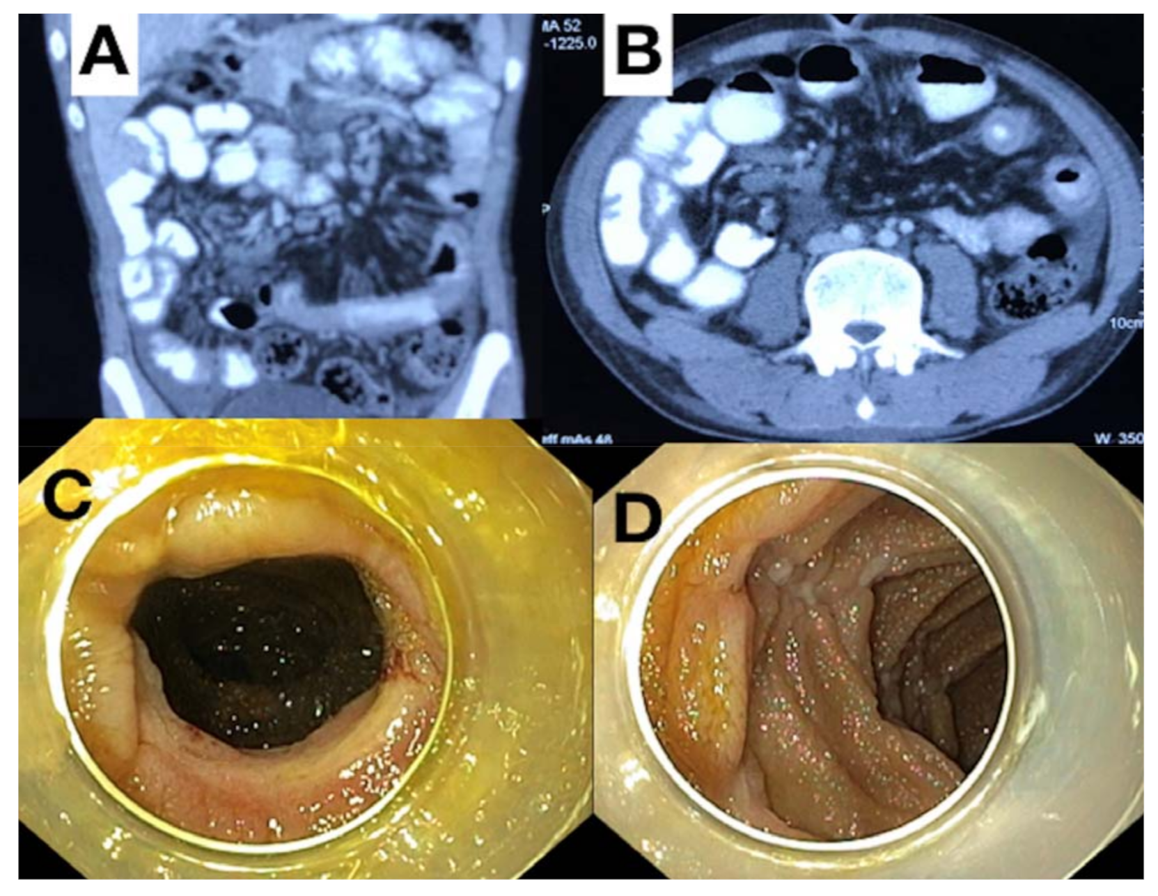 Gastroent 12 00021 g003 Gastroent 12 00021 g003