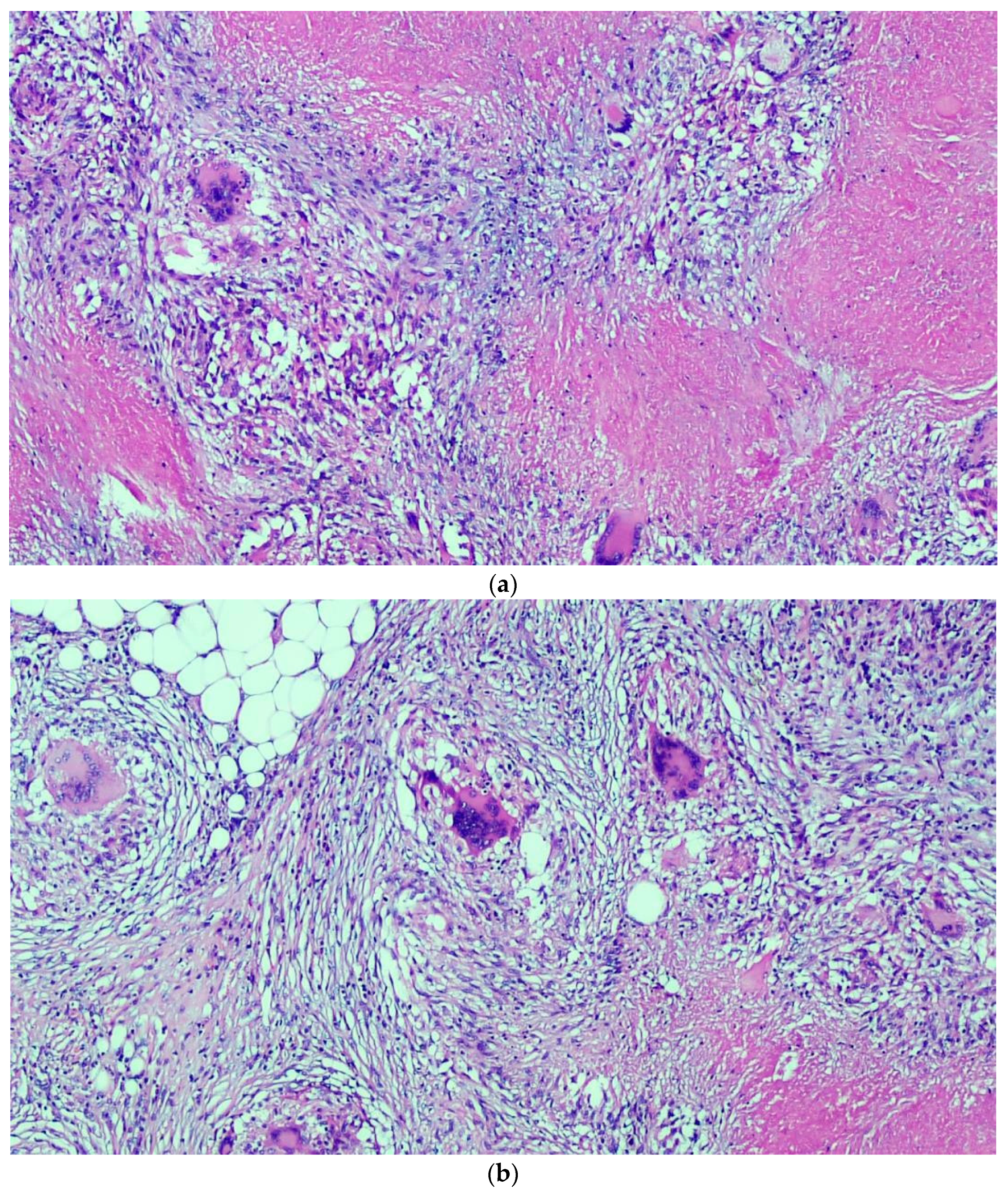 Gastroent 12 00024 g003 Gastroent 12 00024 g003