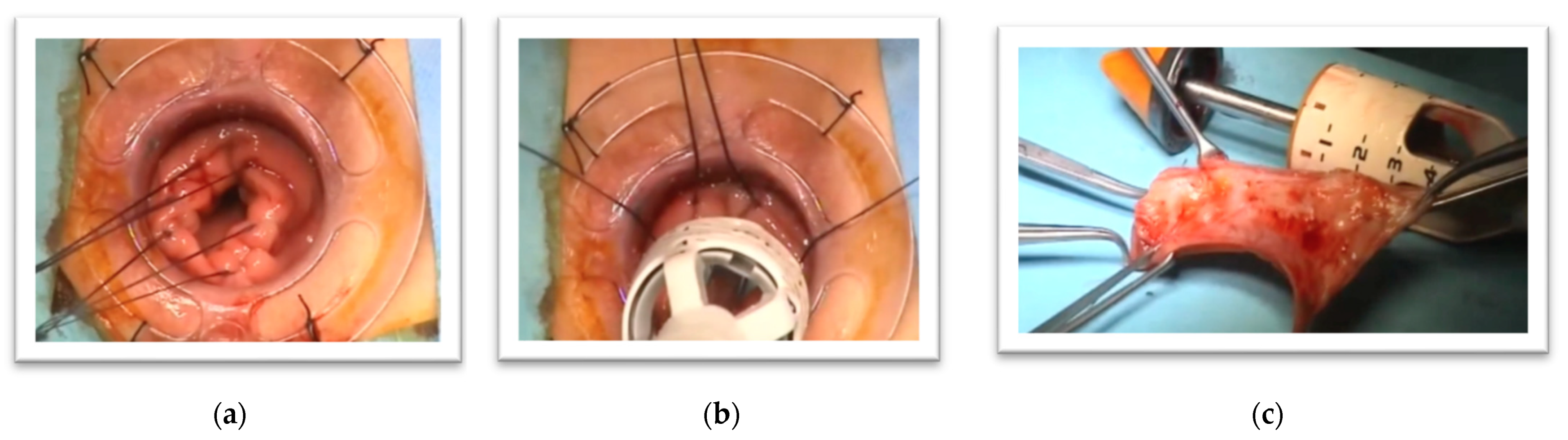 Gastroent 12 00028 g003