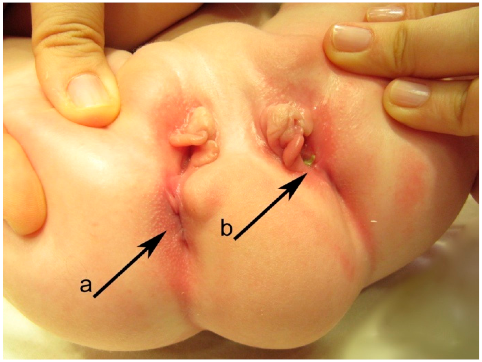 Gastroent 12 00029 g002