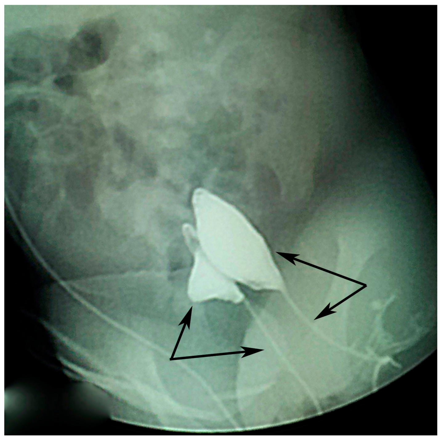 Gastroent 12 00029 g003