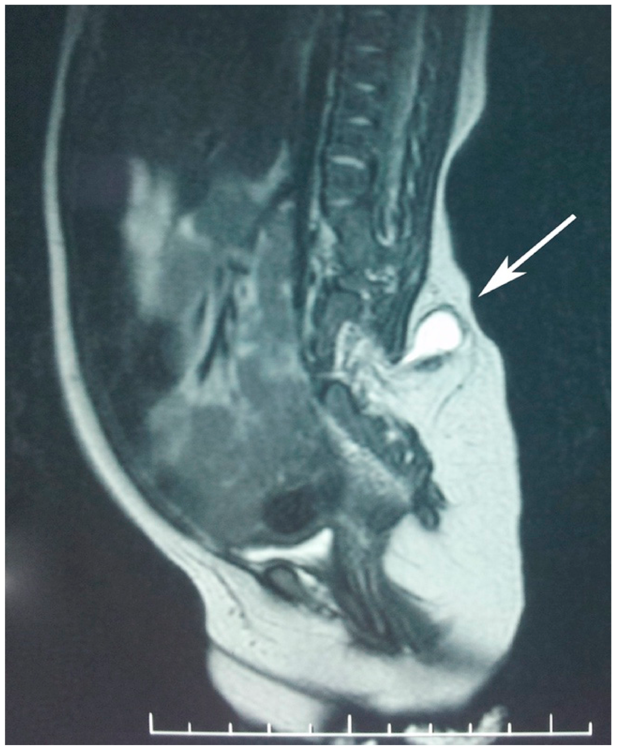 Gastroent 12 00029 g004