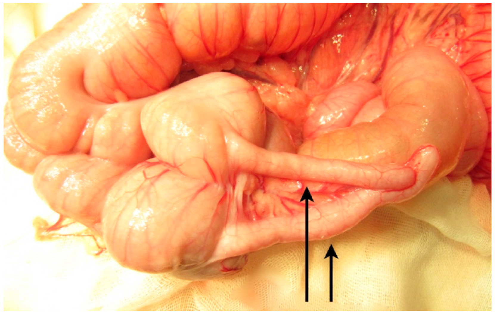 Gastroent 12 00029 g005