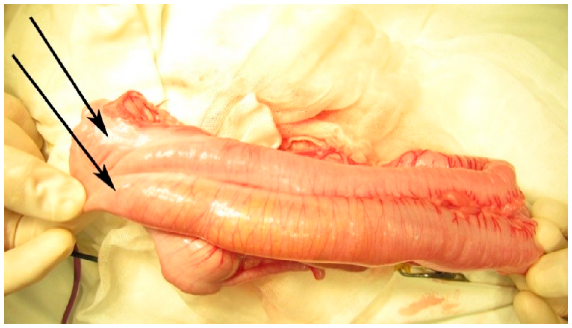 Gastroent 12 00029 g006