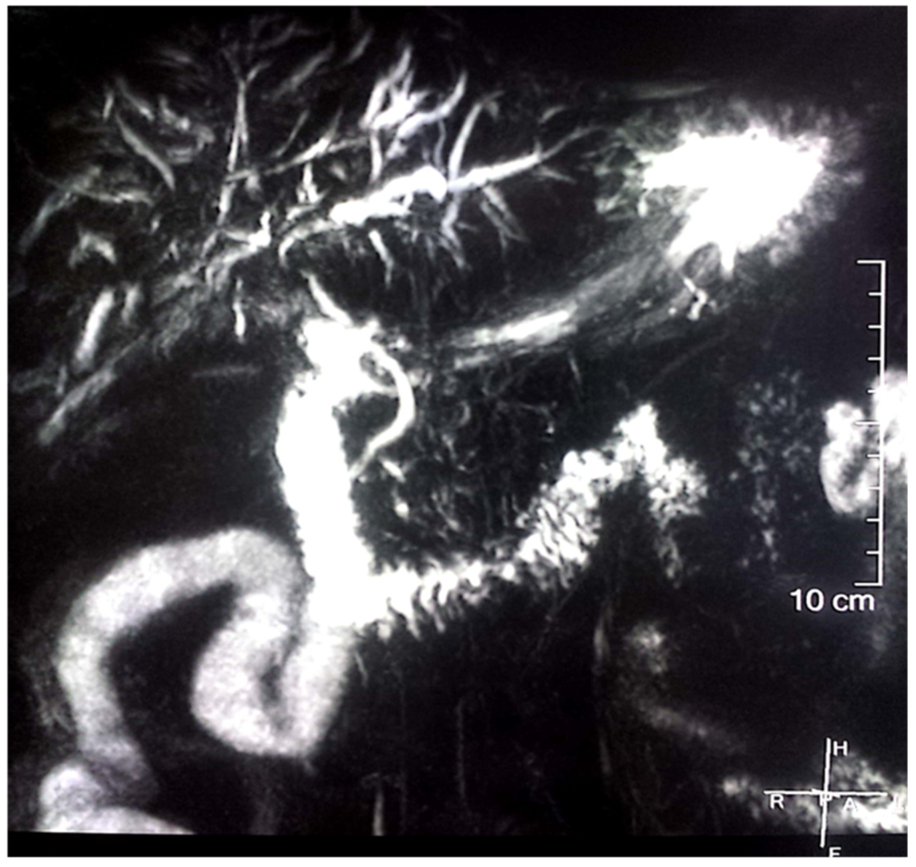 Gastroent 12 00033 g001 Gastroent 12 00033 g001