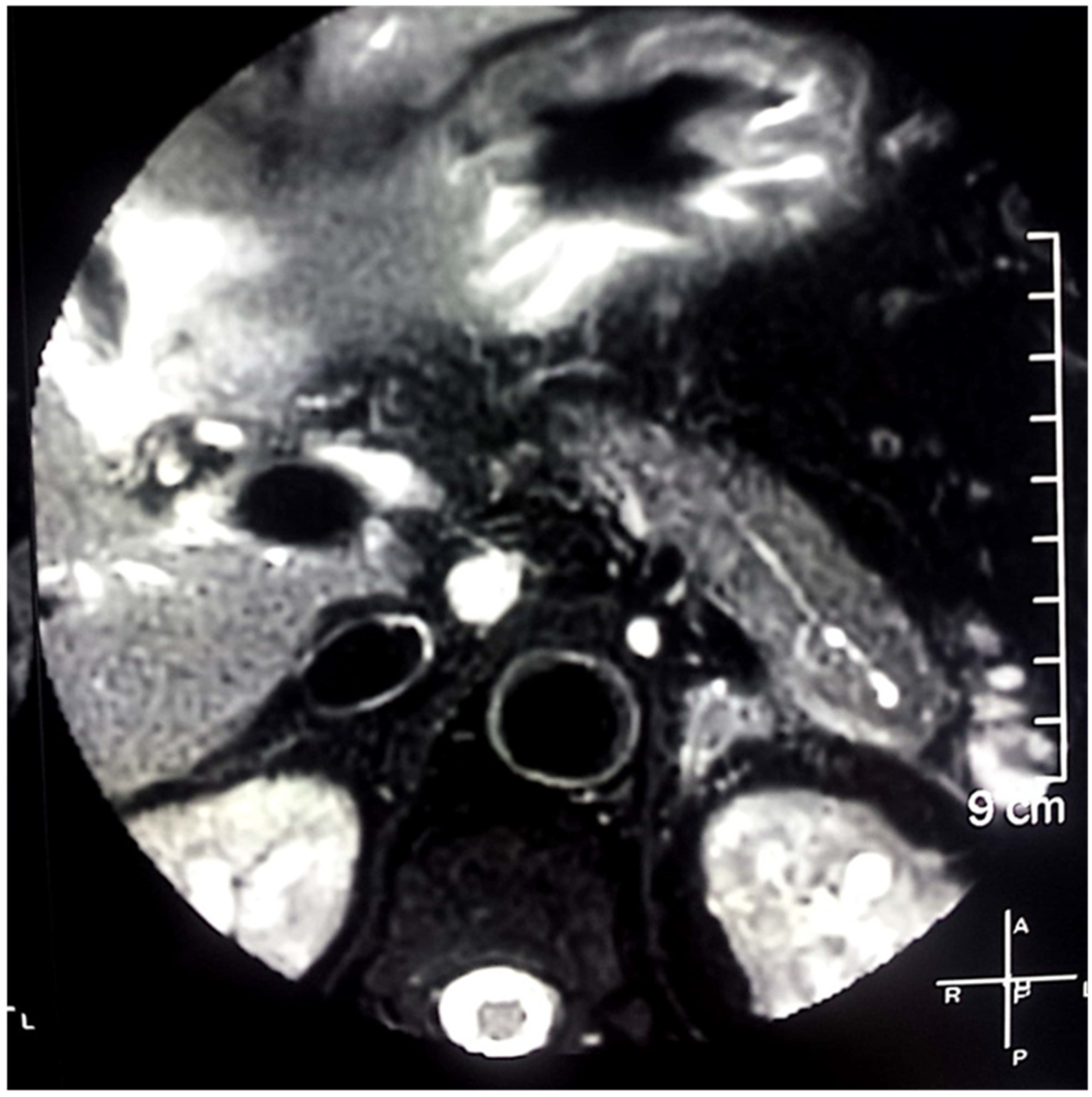 Gastroent 12 00033 g002 Gastroent 12 00033 g002