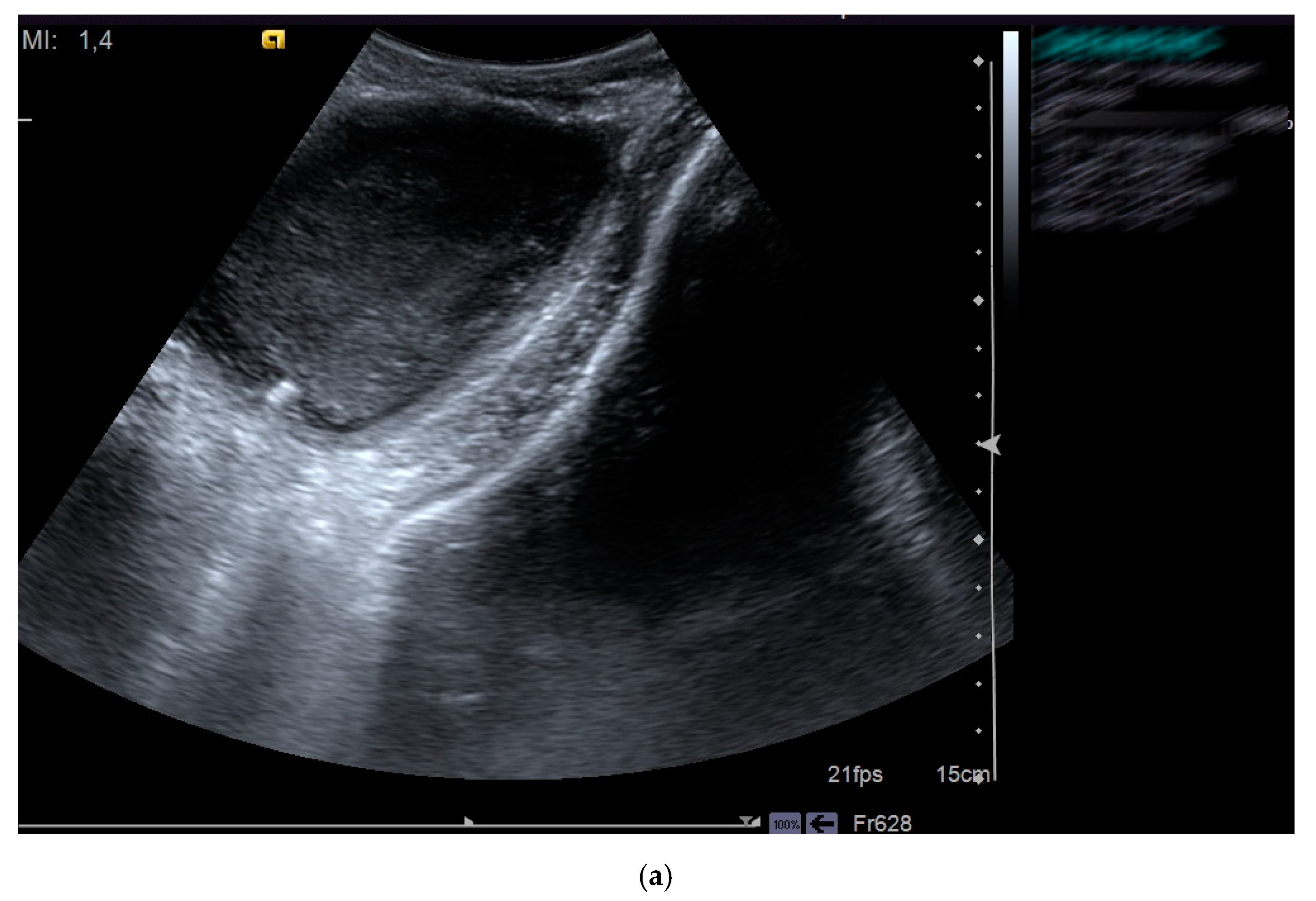 Gastroent 12 00035 g003a
