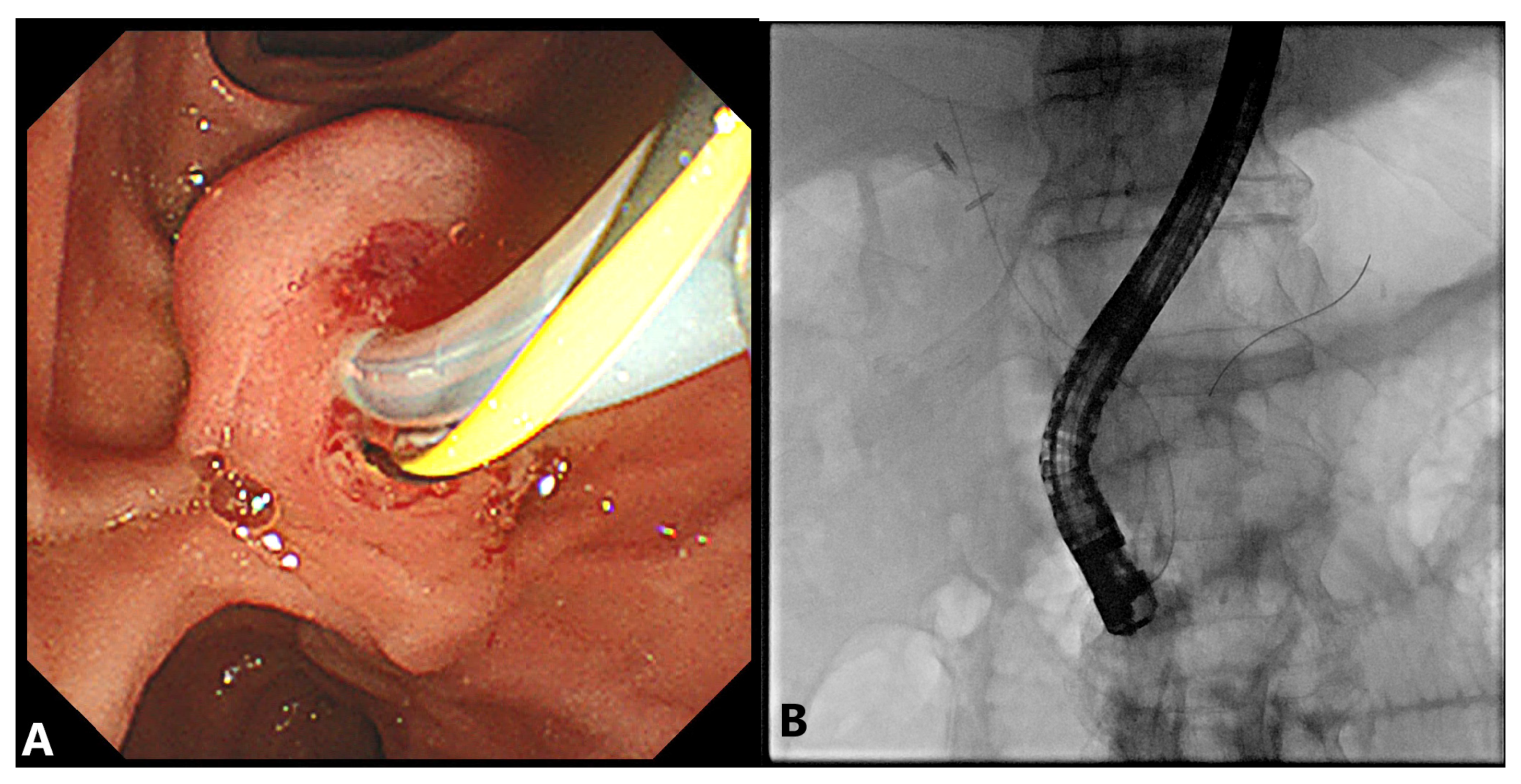 Gastroent 12 00039 g003 Gastroent 12 00039 g003