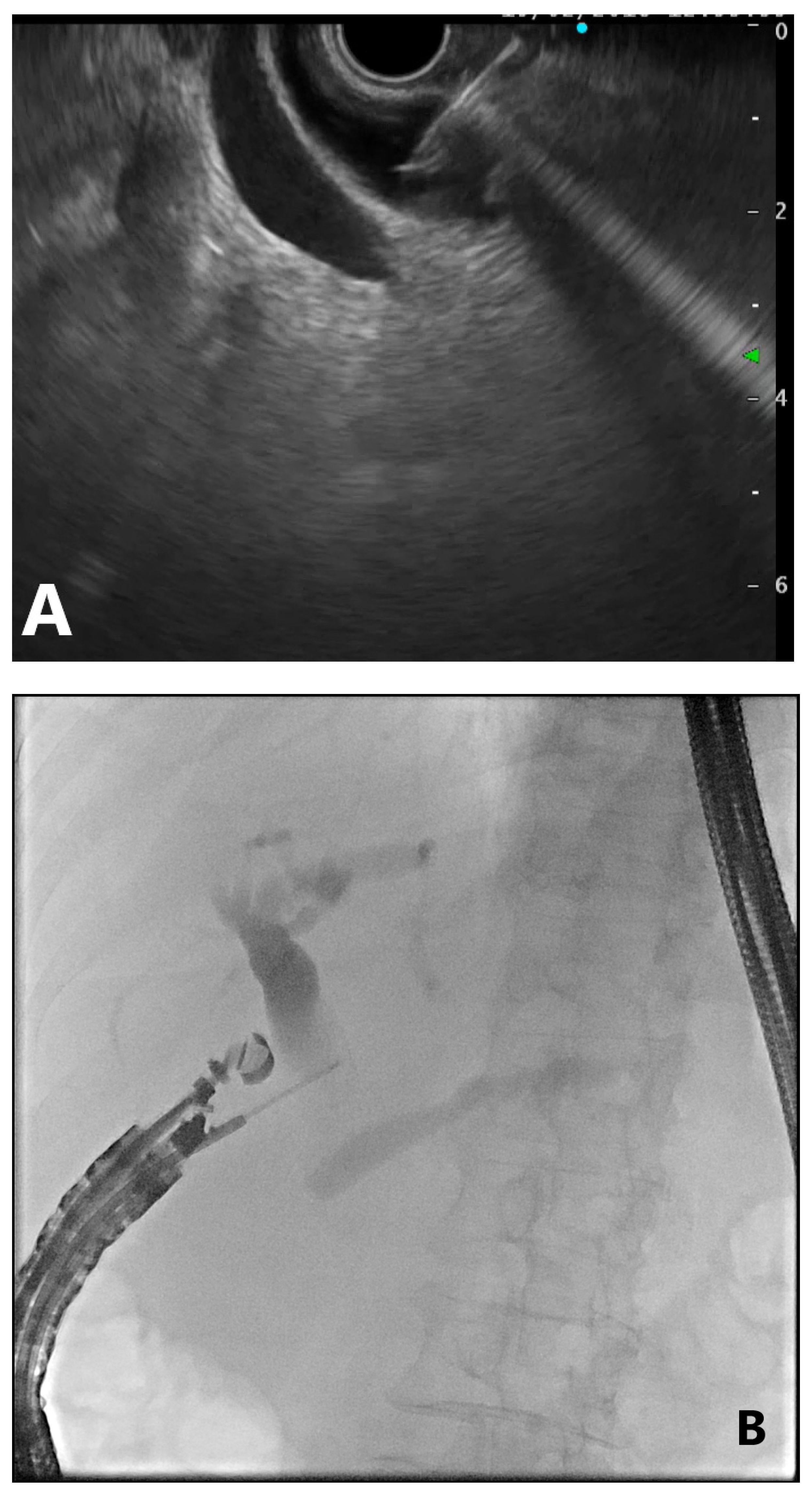 Gastroent 12 00039 g006a Gastroent 12 00039 g006a