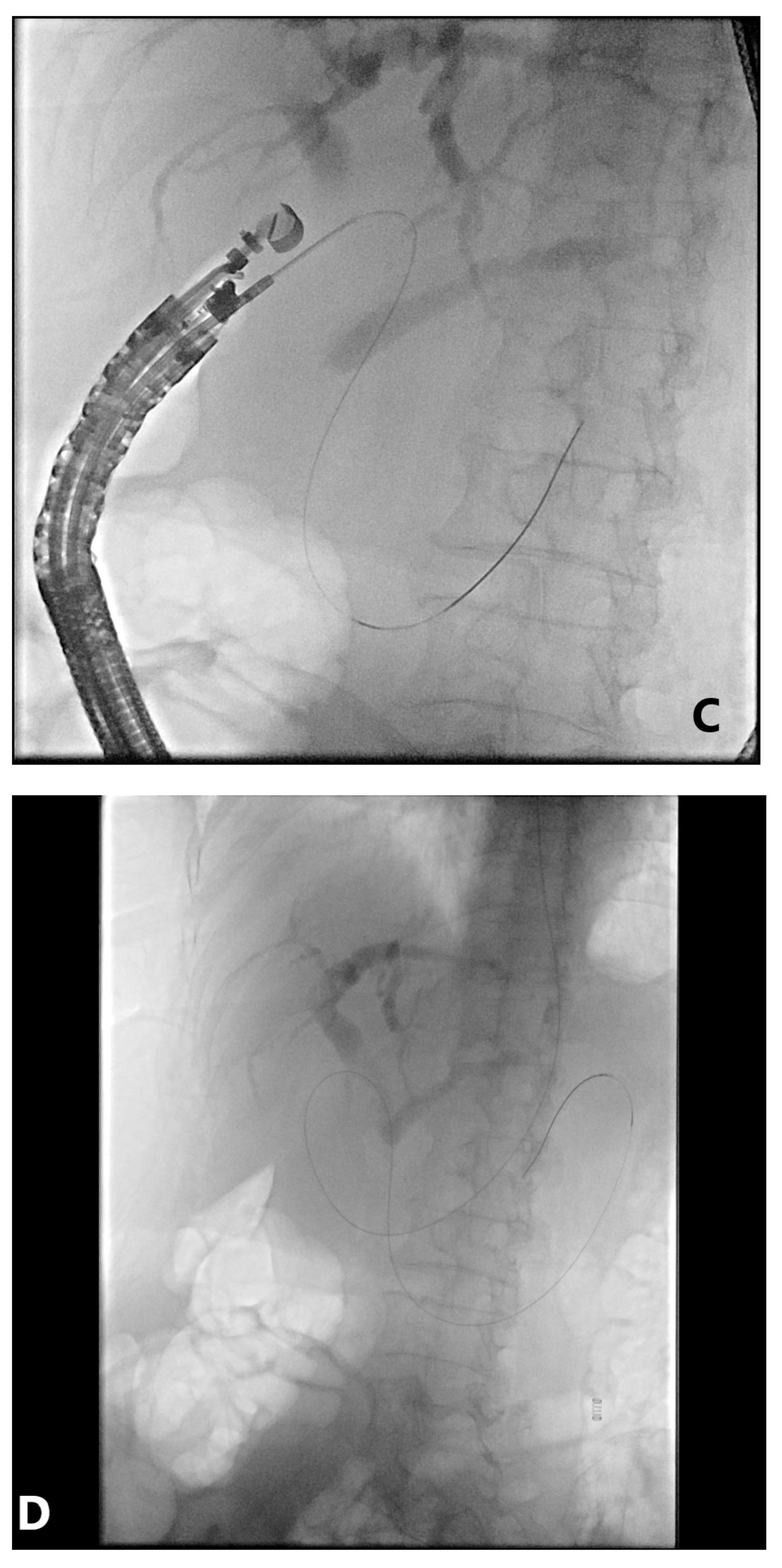 Gastroent 12 00039 g006b Gastroent 12 00039 g006b