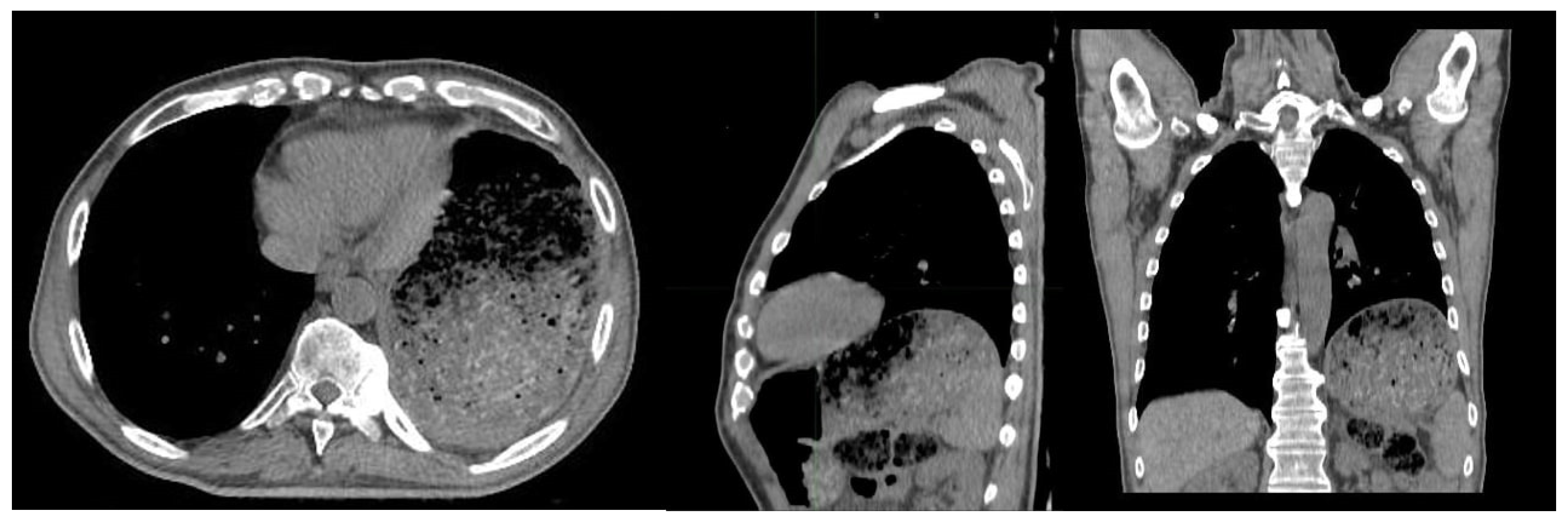 Gastroent 13 00004 g003