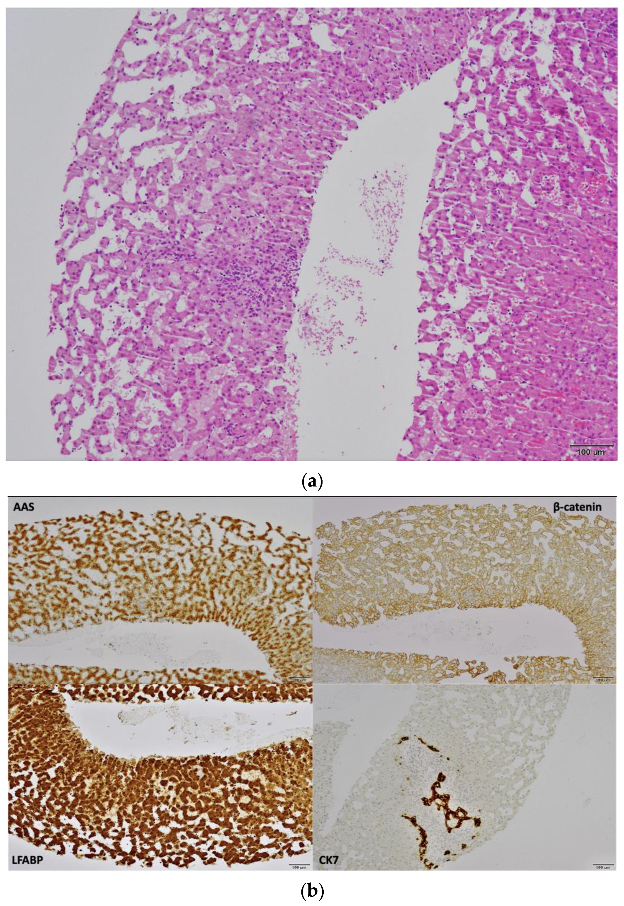 Gastroent 13 00008 g002 550
