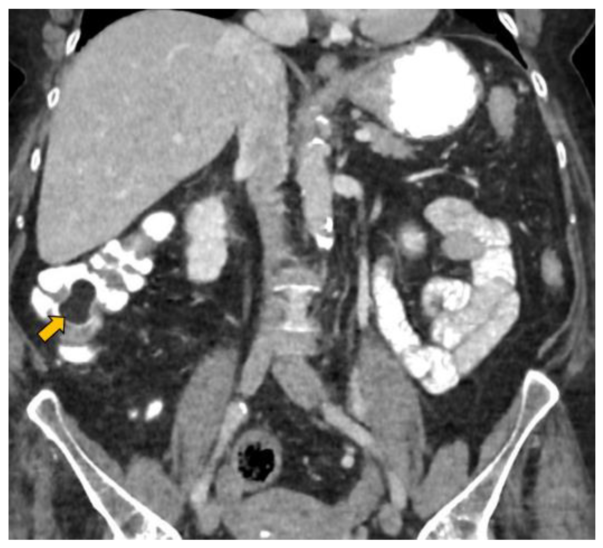 Gastroent 13 00018 g002