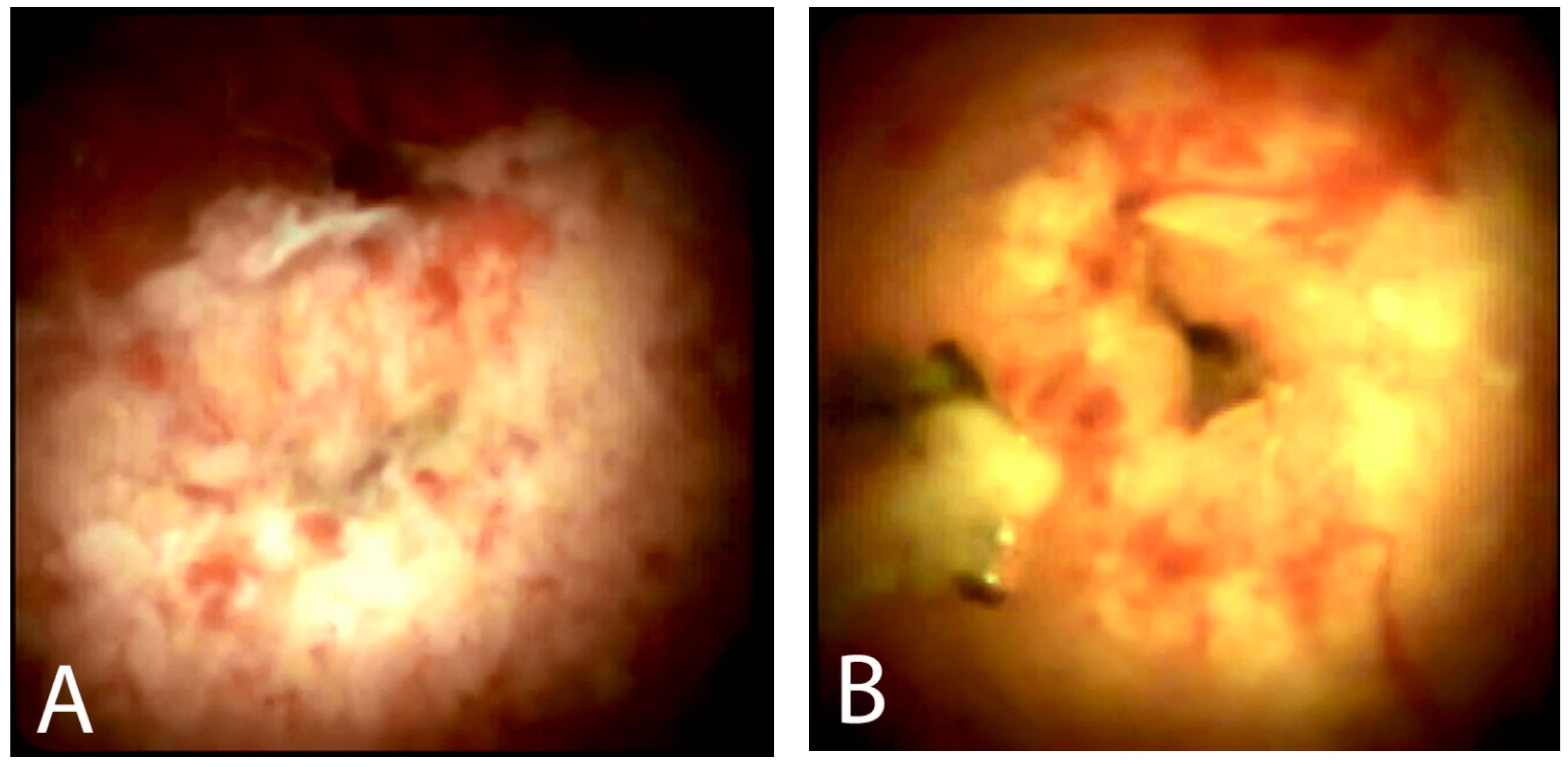 Gastroent 13 00020 g005