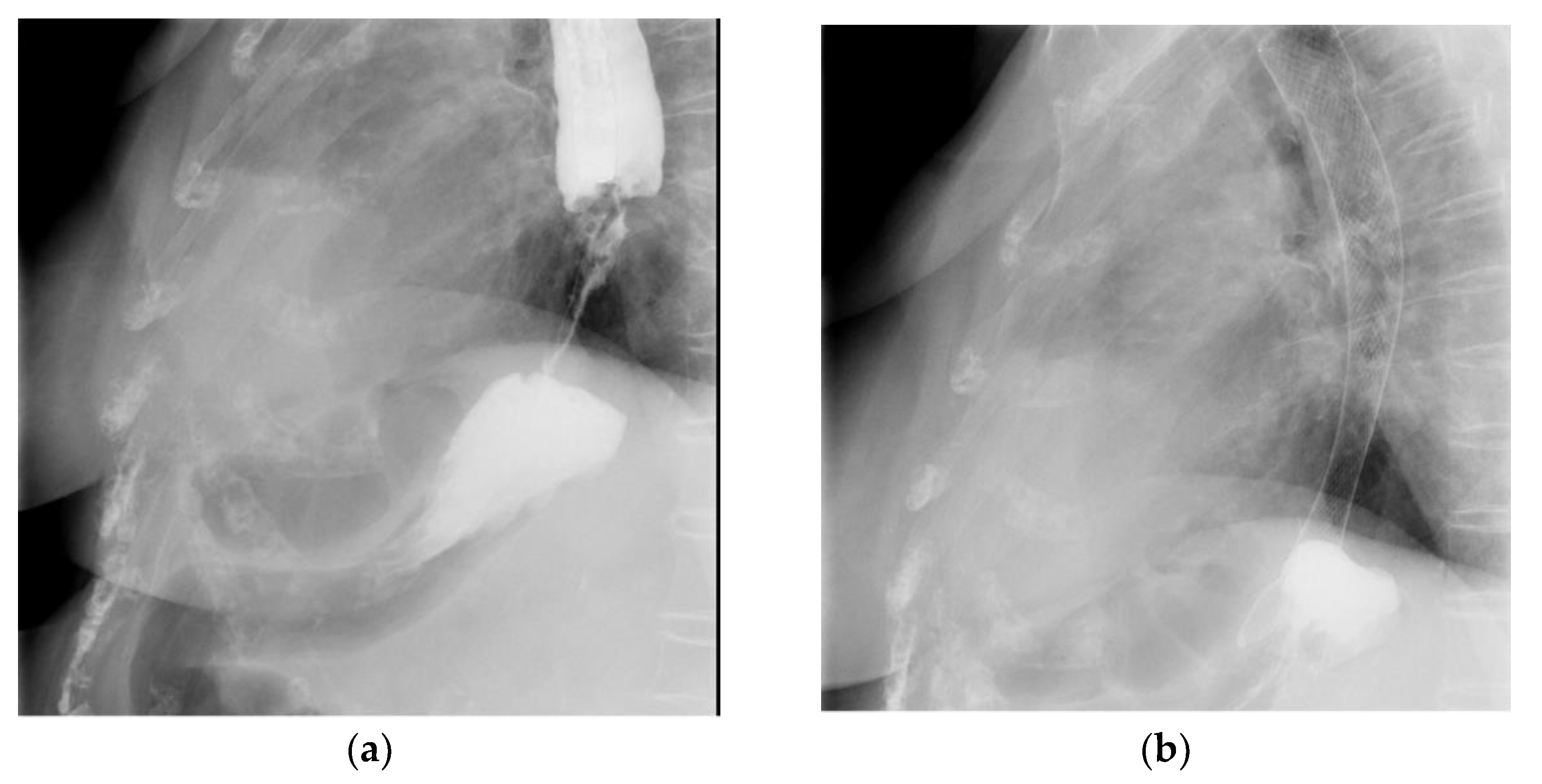 Gastroent 13 00025 g002 Gastroent 13 00025 g002