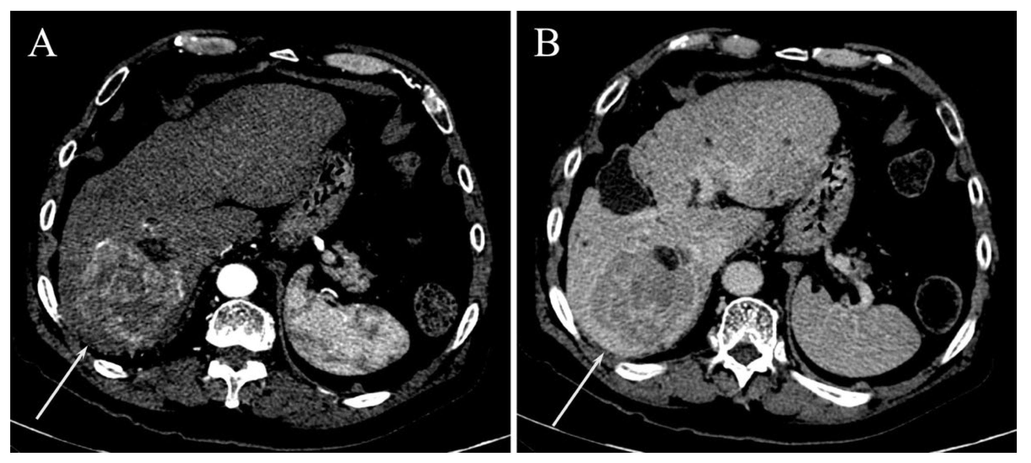 Gastroent 13 00028 g002 550