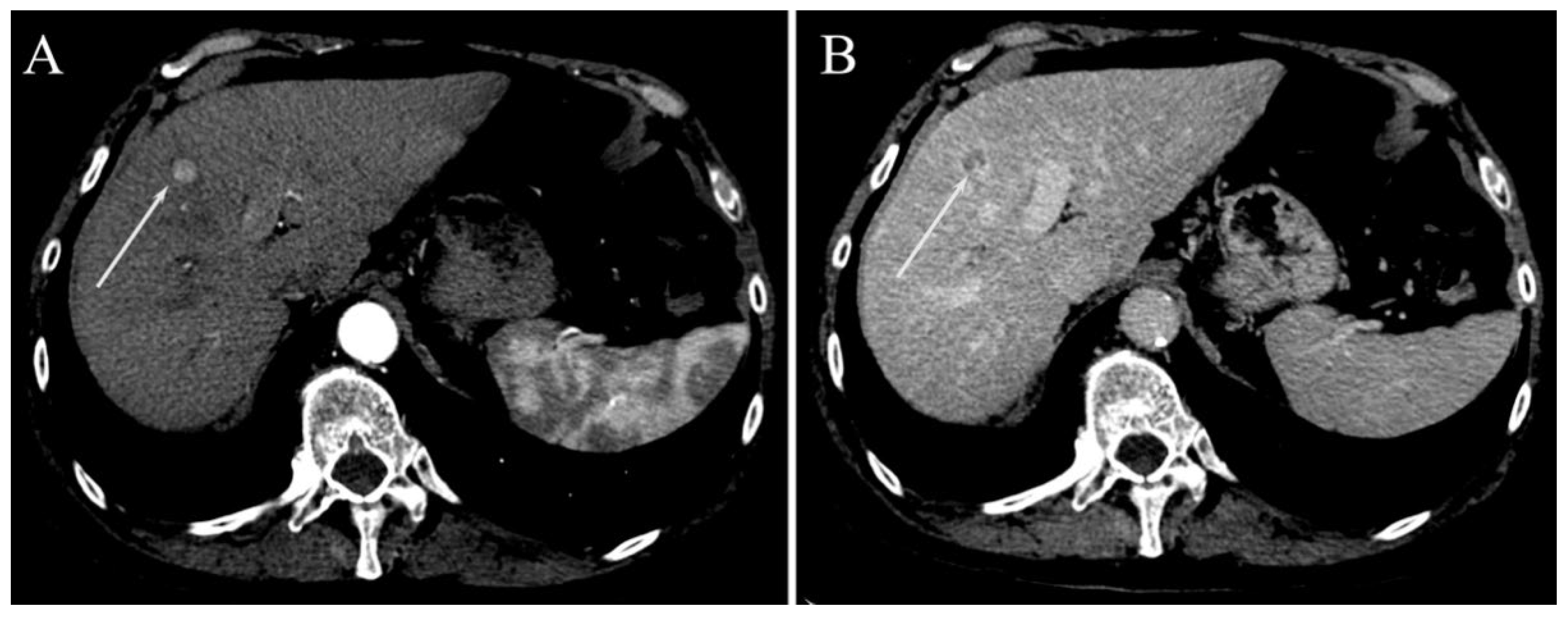 Gastroent 13 00028 g003 550