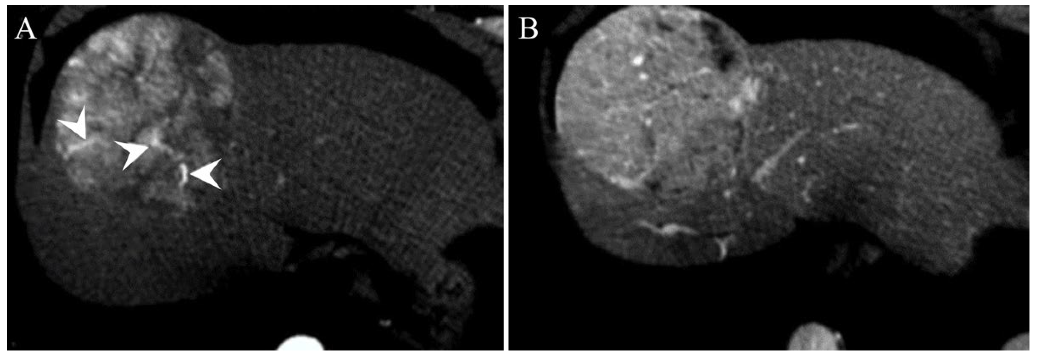Gastroent 13 00028 g004 550
