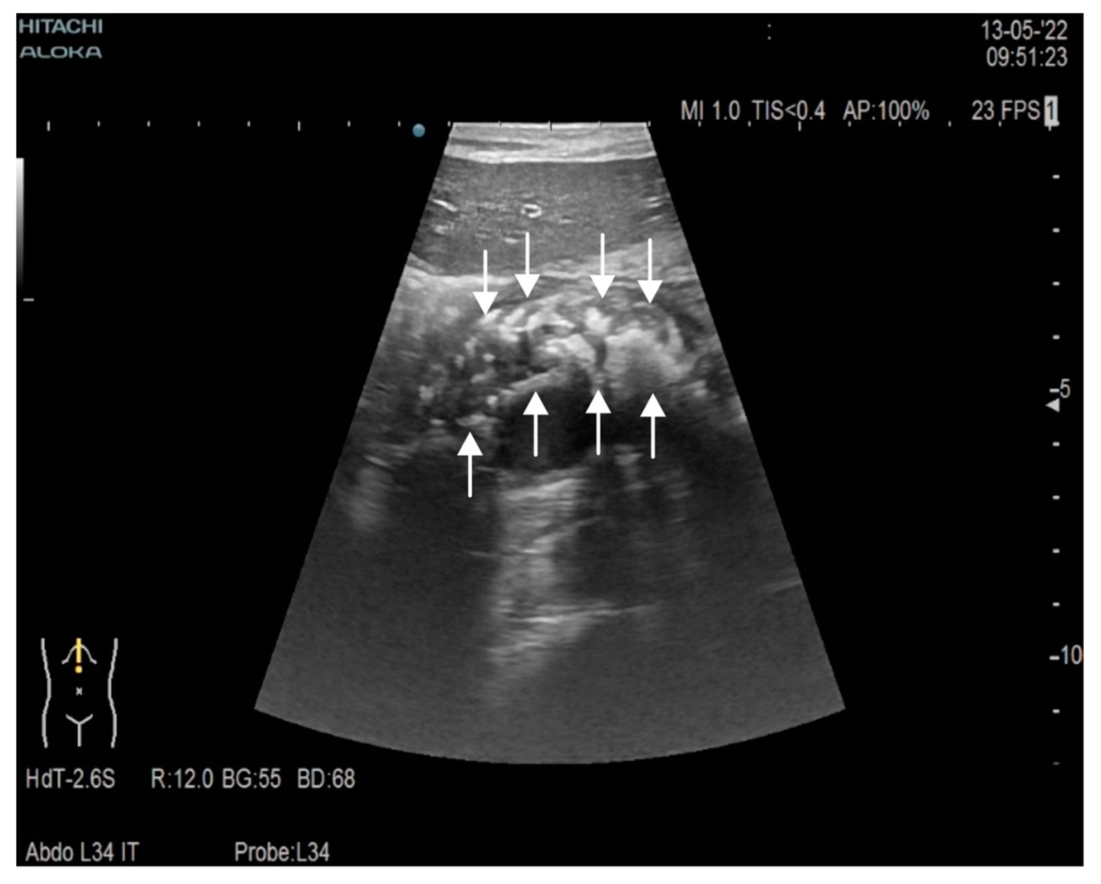 Gastroent 13 00031 g001 550