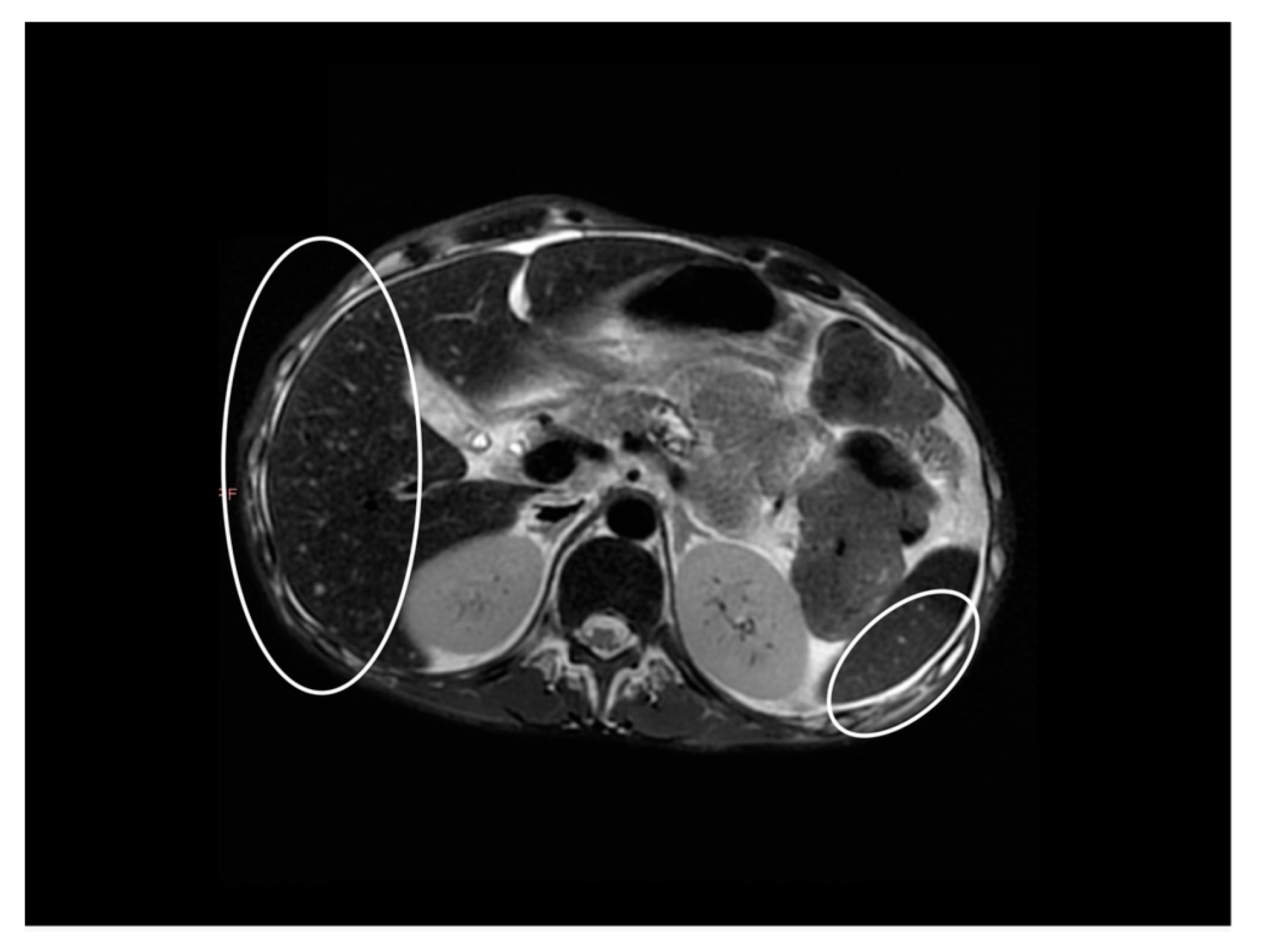 Gastroent 13 00031 g003 550