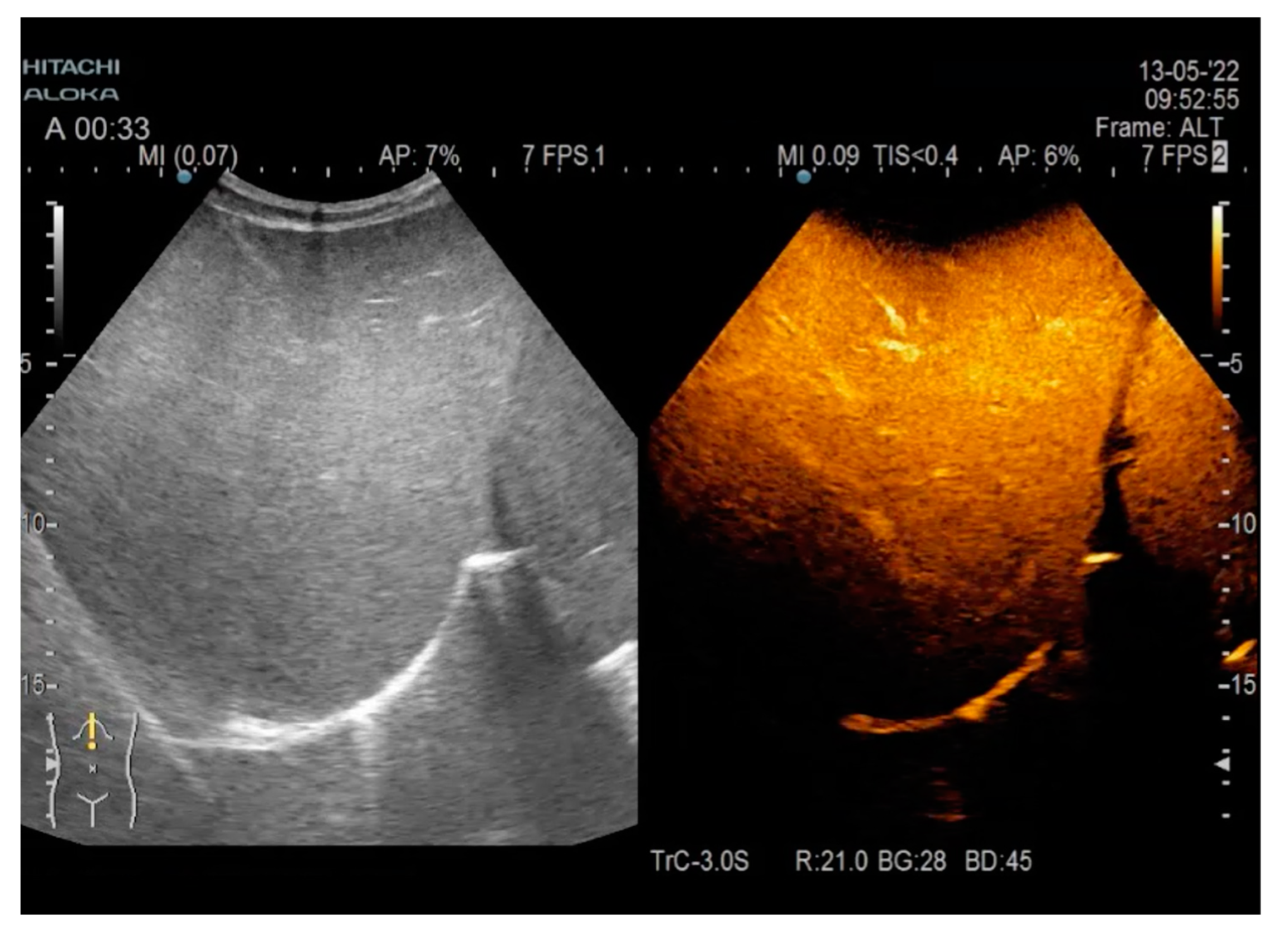 Gastroent 13 00031 g004 550