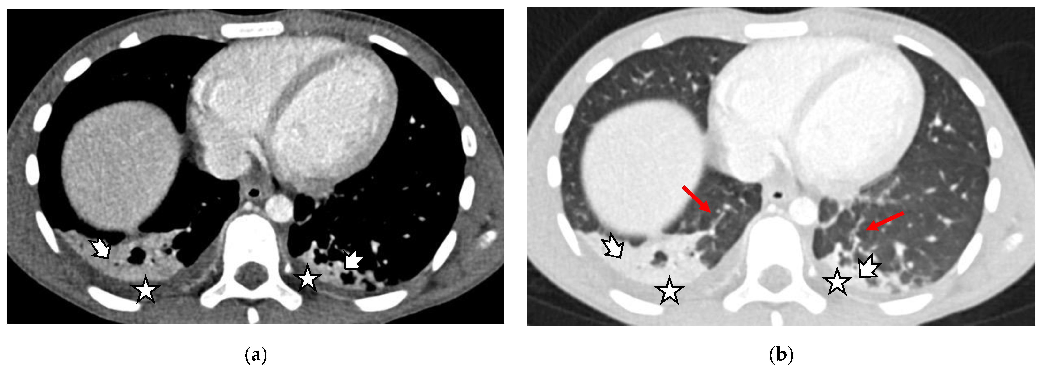Gastroent 13 00032 g002