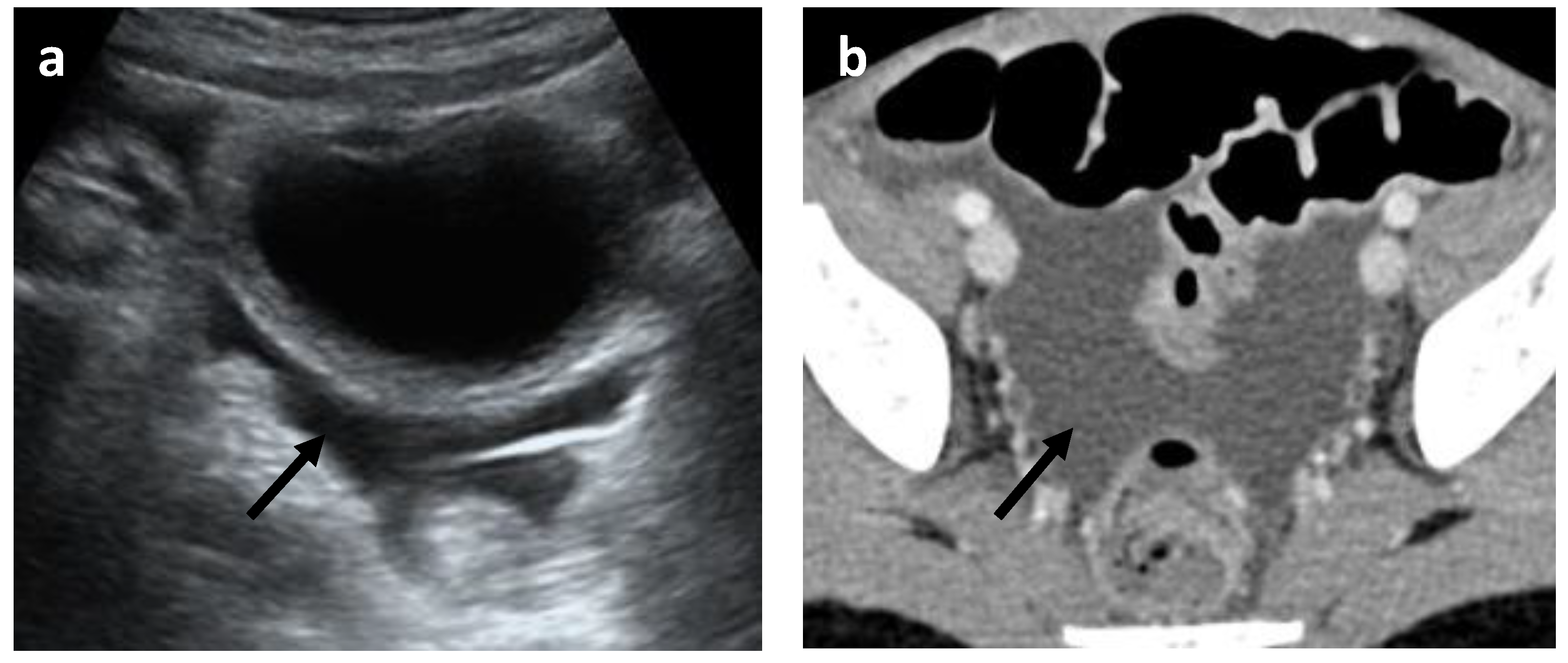 Gastroent 13 00032 g006