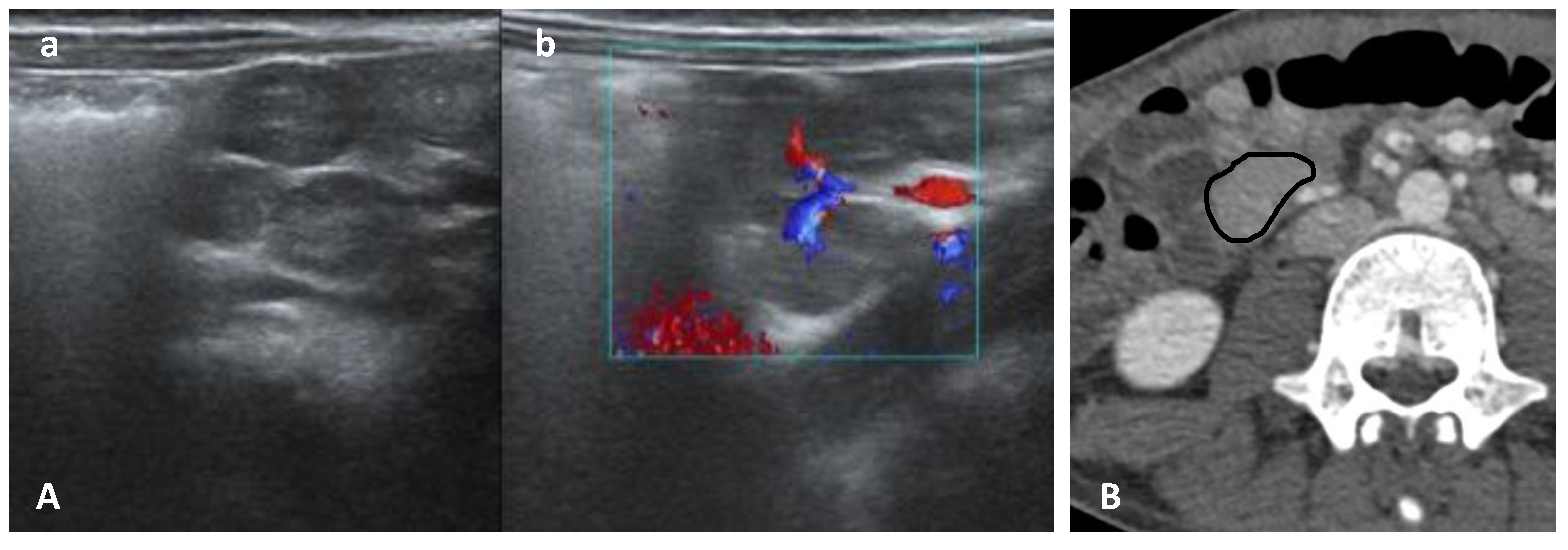 Gastroent 13 00032 g007